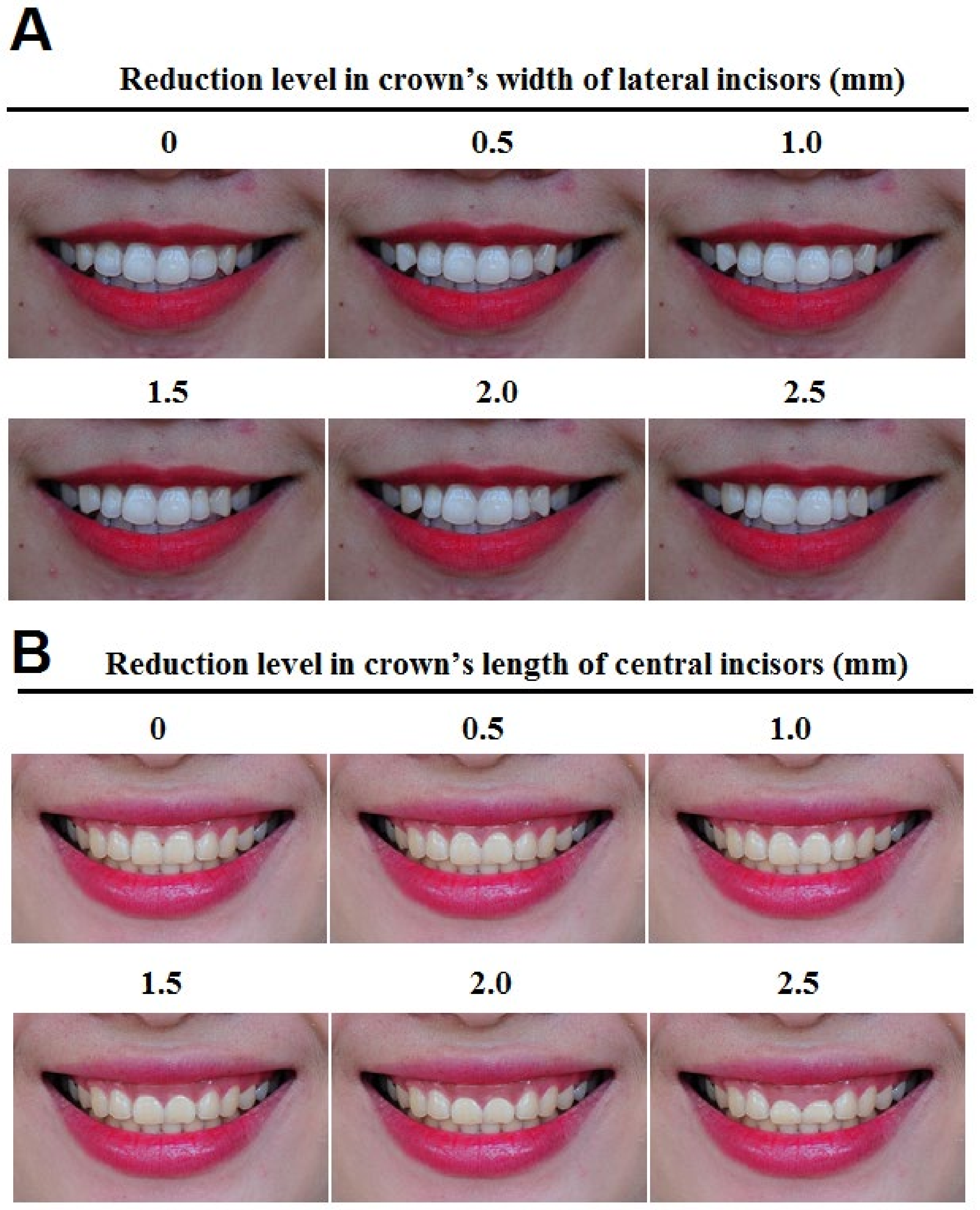 Ijerph 17 01638 g001 Ijerph 17 01638 g001
