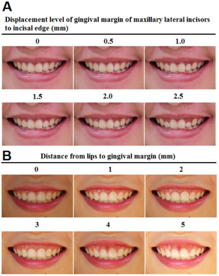 39 Creative Dental design smile atlanta for Ideas