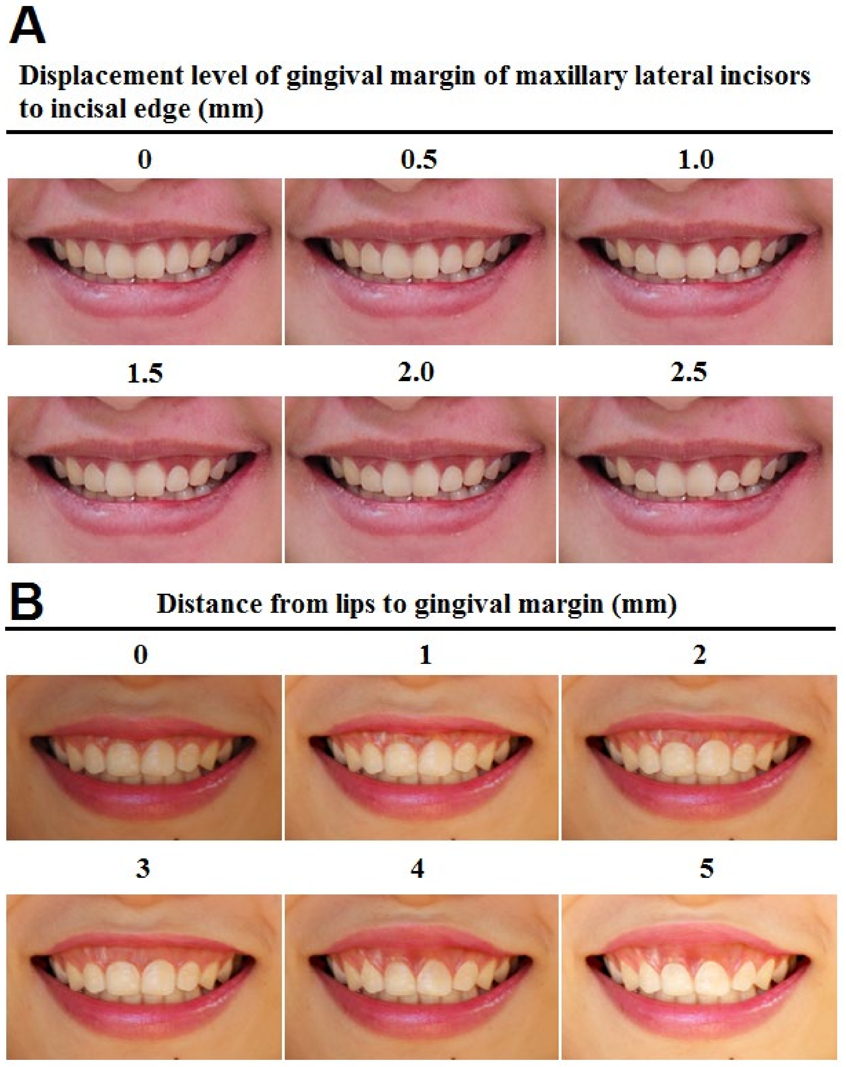 Ijerph 17 01638 g002 Ijerph 17 01638 g002
