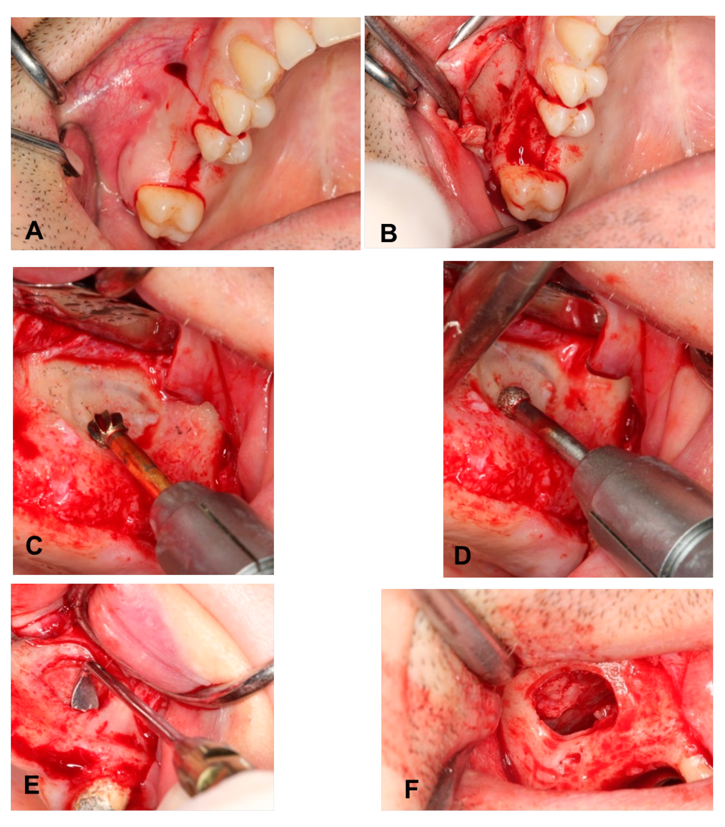 Ijerph 17 01918 g001