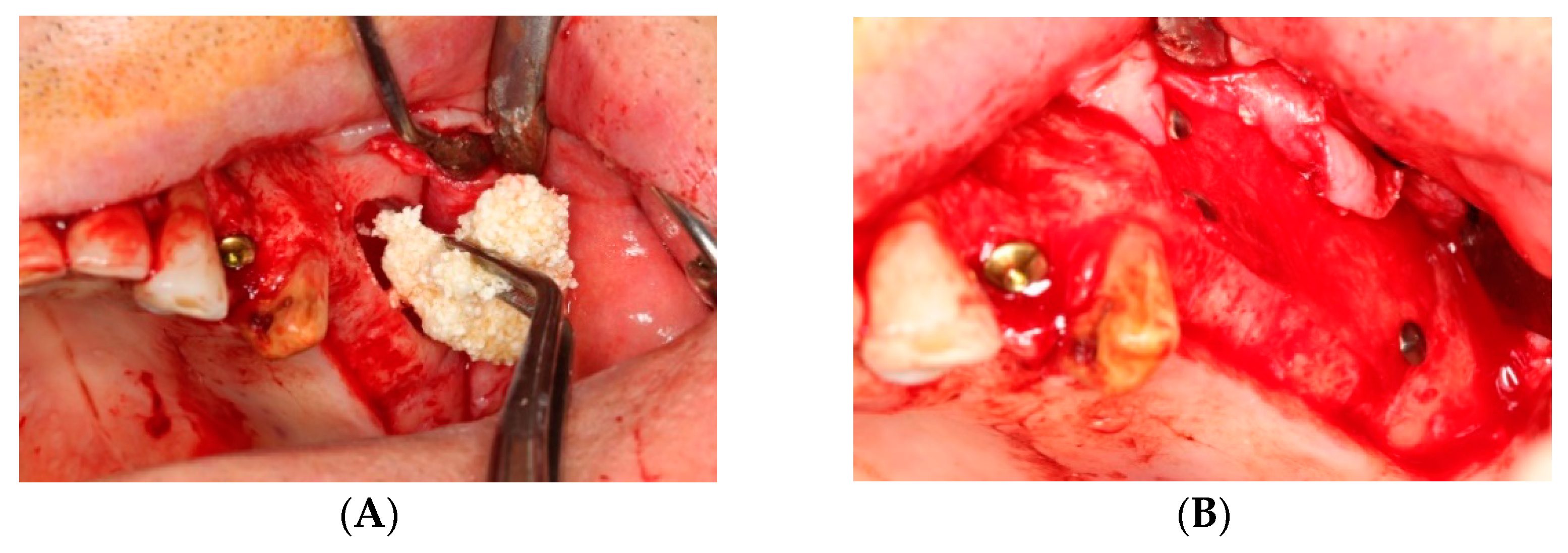 Ijerph 17 01918 g004