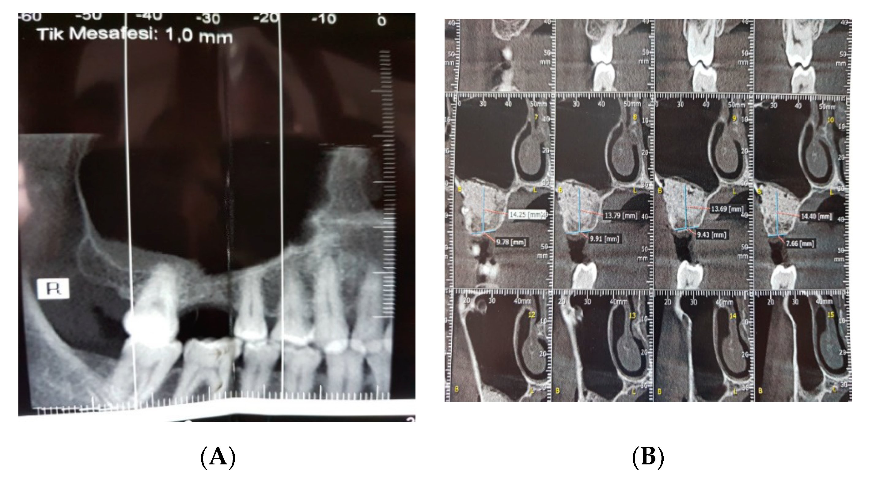 Ijerph 17 01918 g005