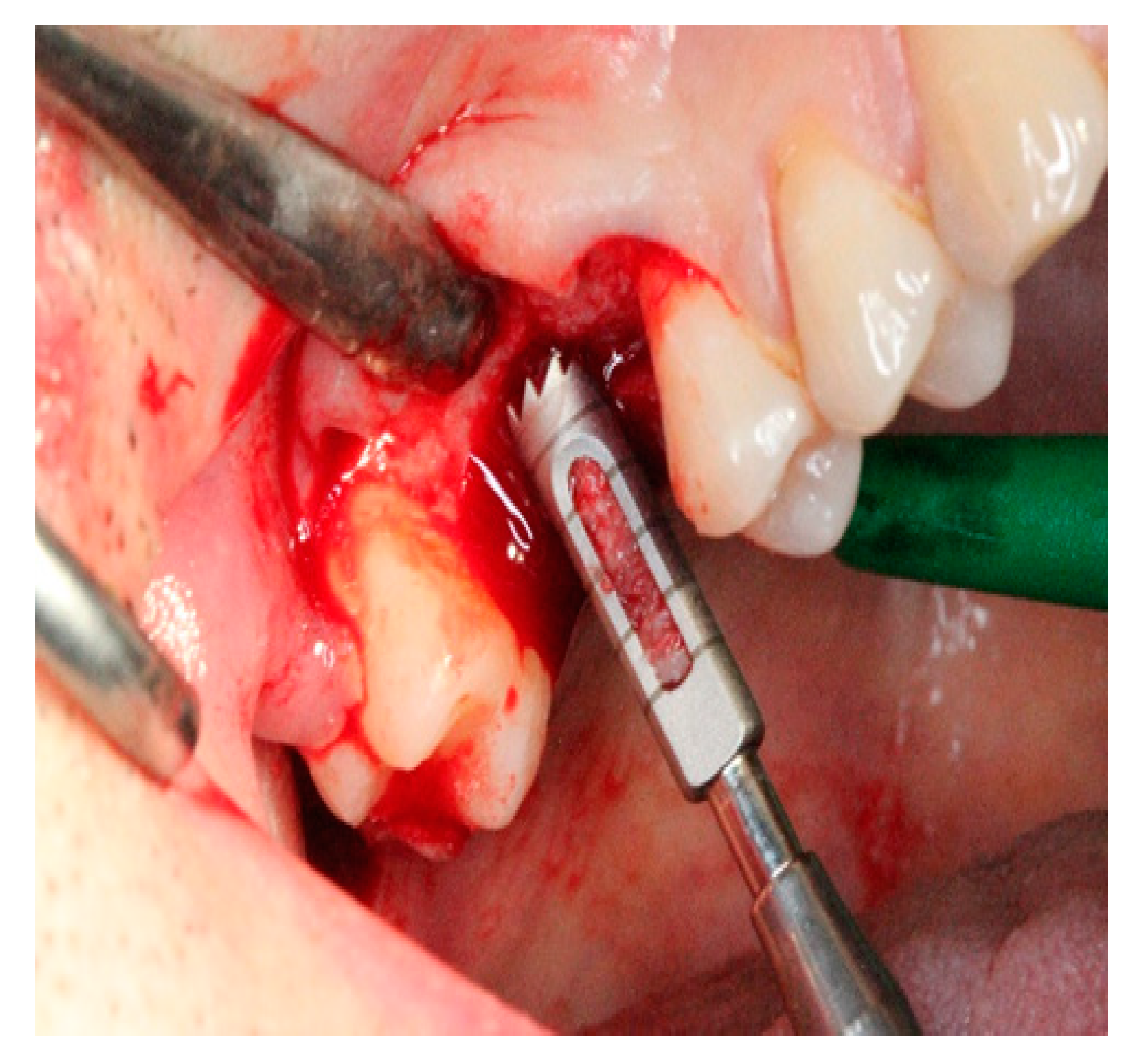 Ijerph 17 01918 g007