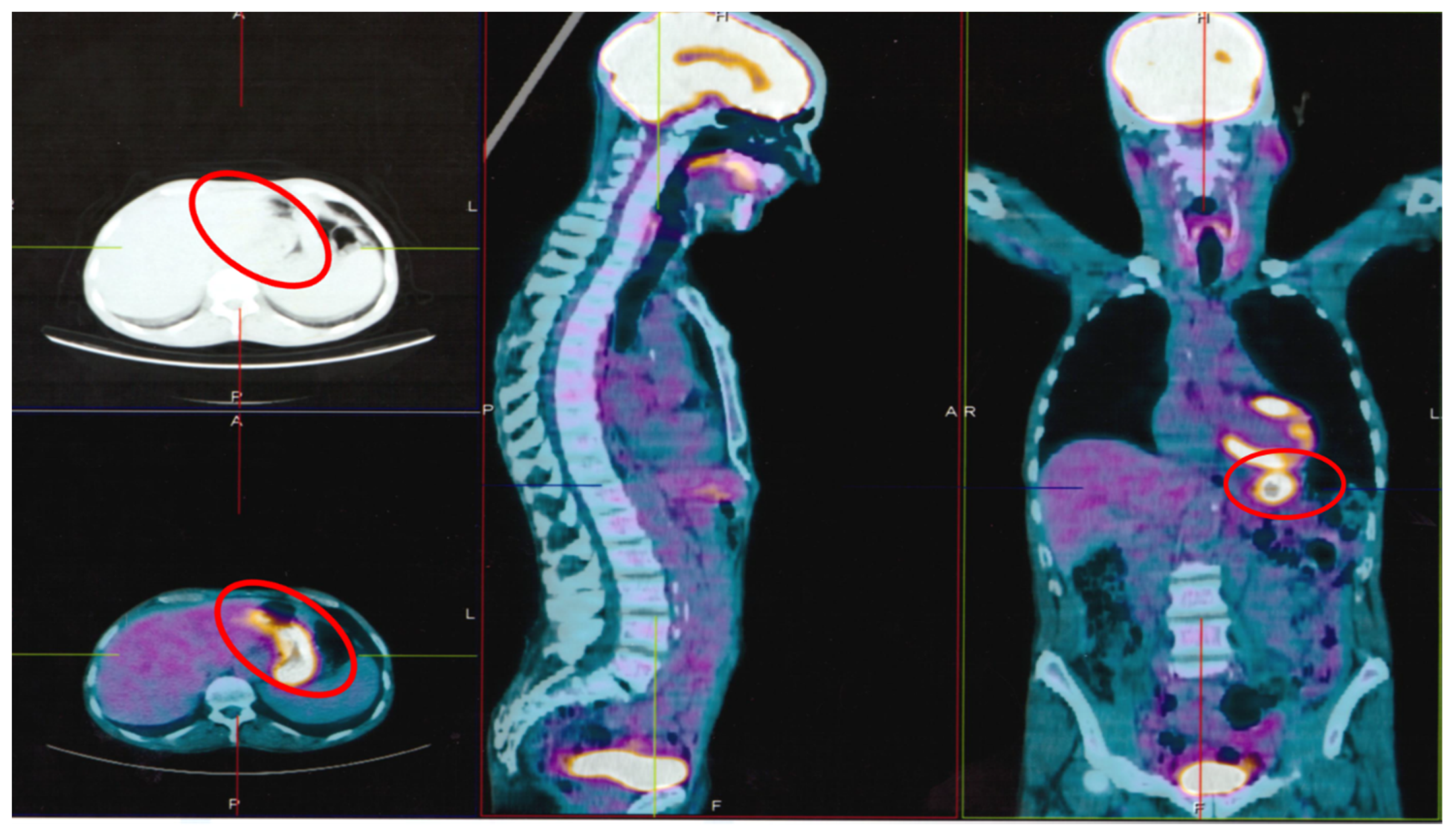 Ijerph 17 01929 g001