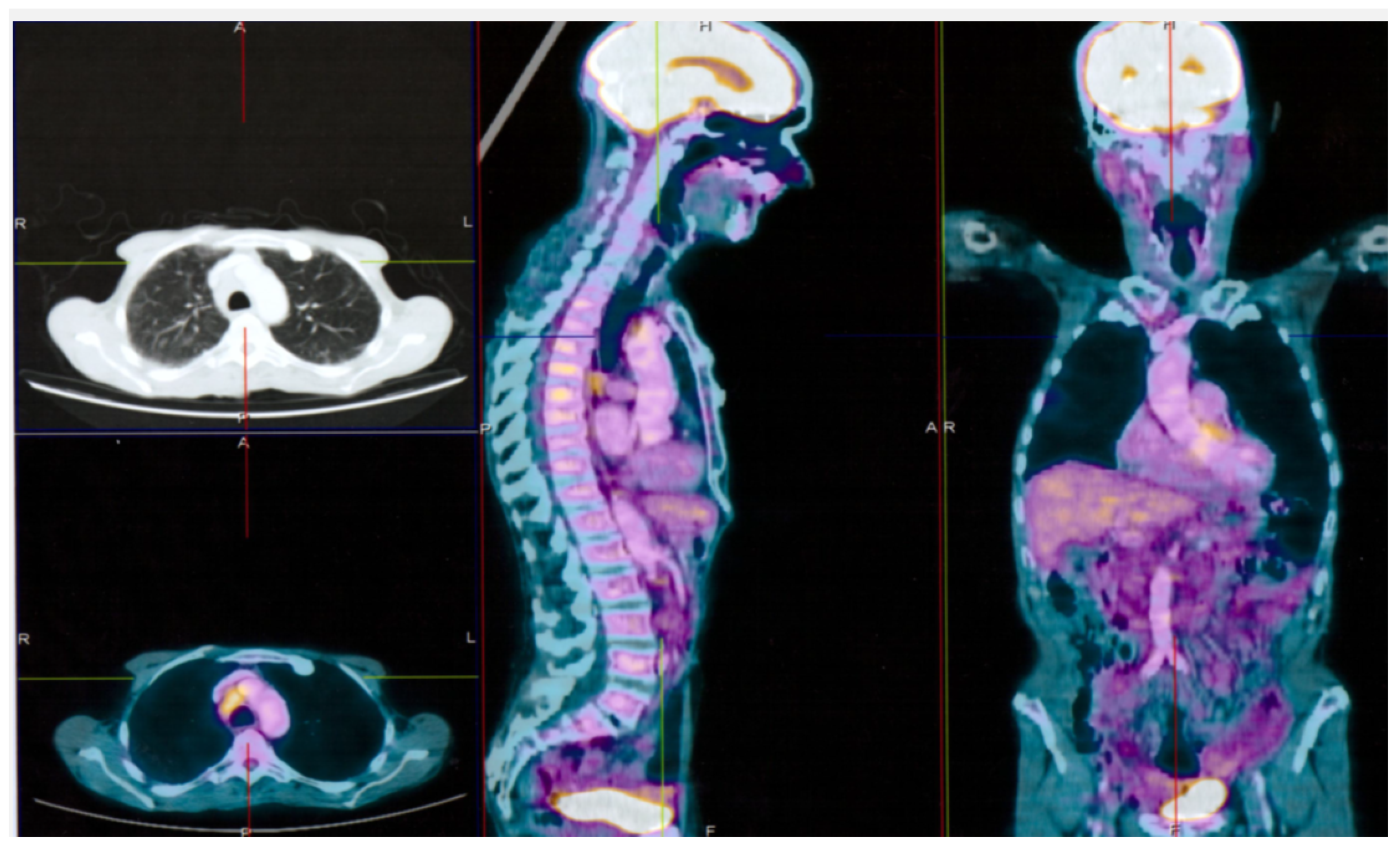 Ijerph 17 01929 g002