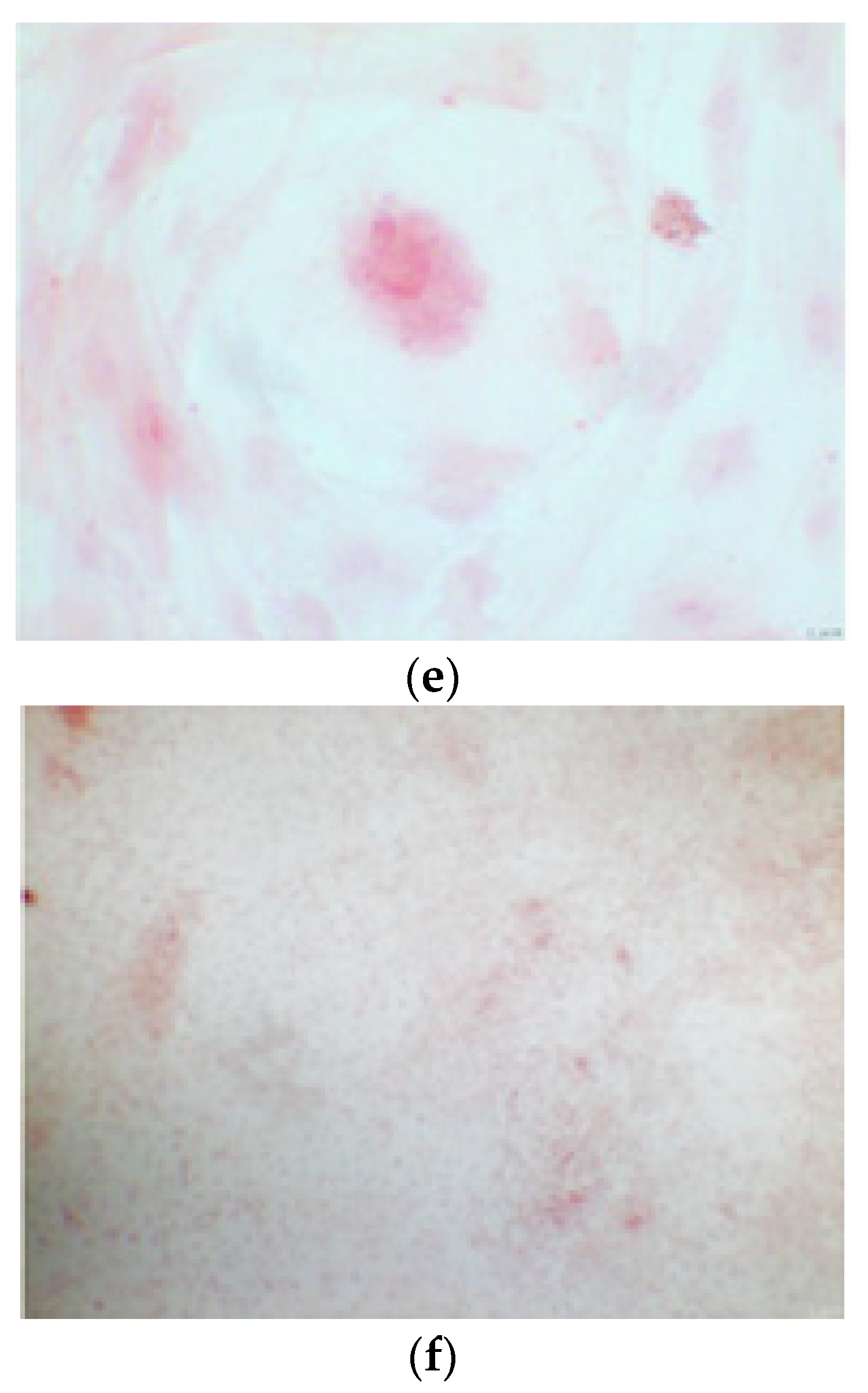 Ijerph 17 01947 g008b Ijerph 17 01947 g008b