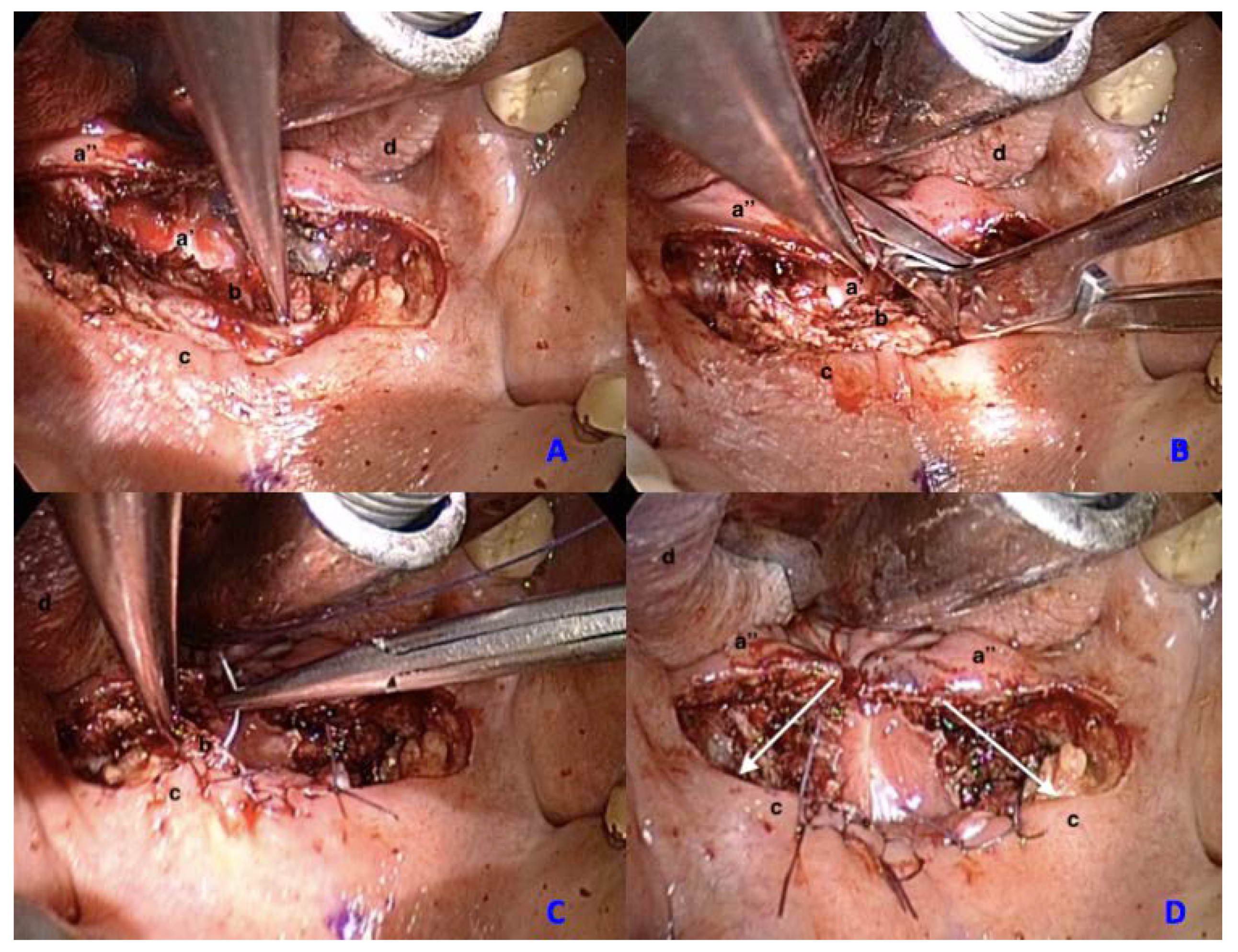 Ijerph 17 02048 g002