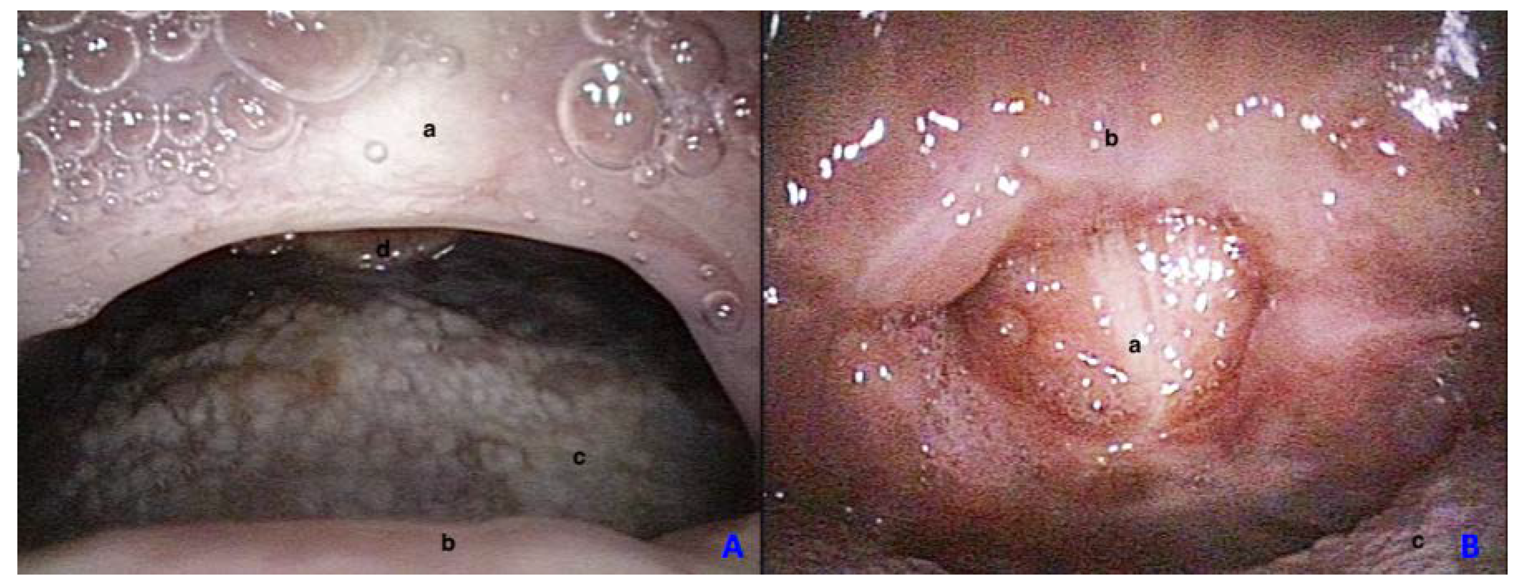 Ijerph 17 02048 g003