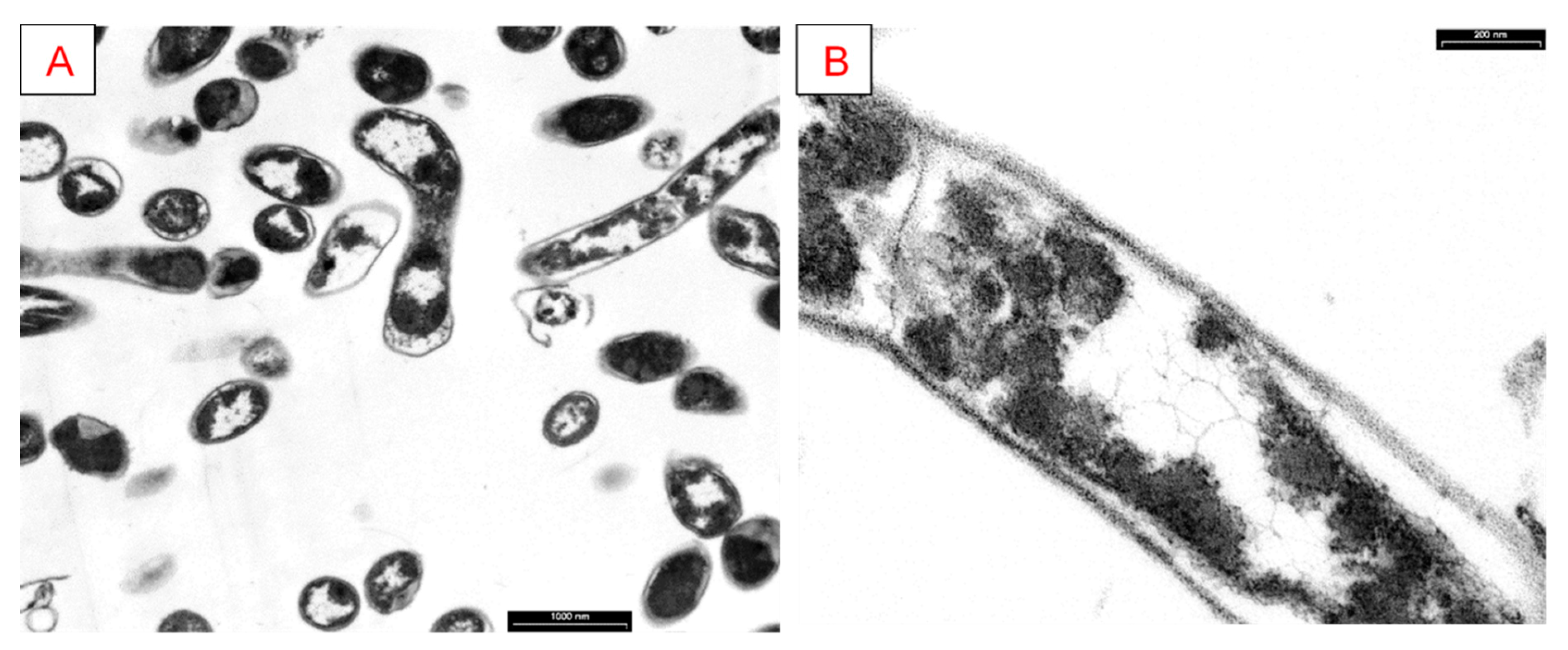 Ijerph 17 02678 g005