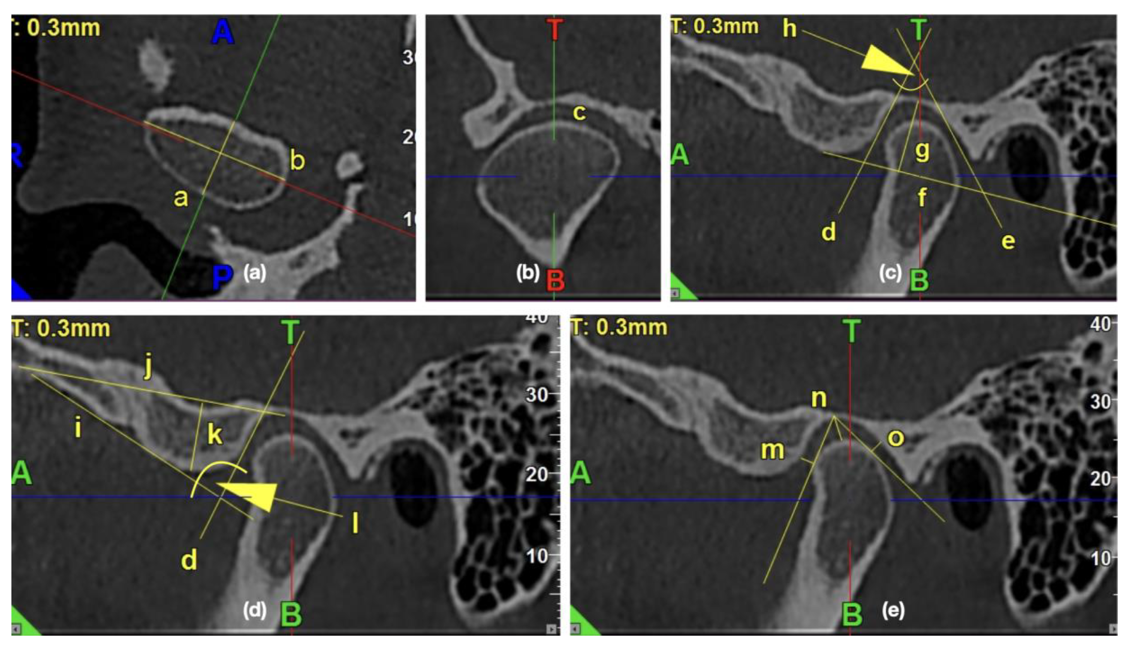 Ijerph 17 02923 g002