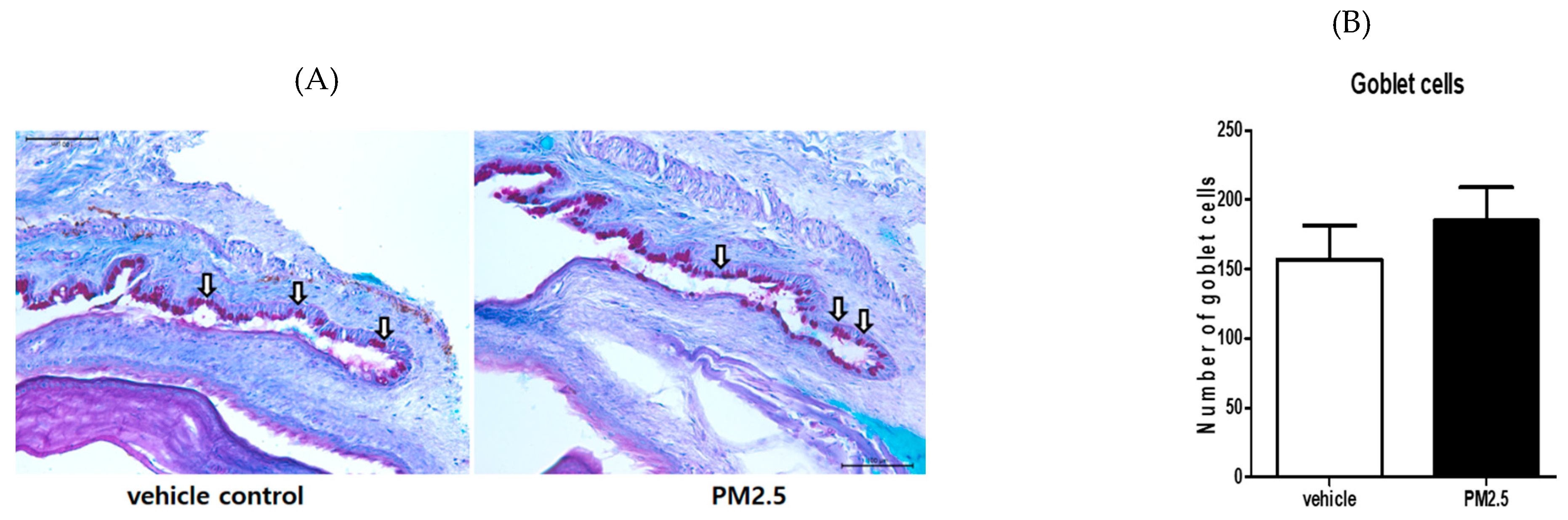 Ijerph 17 02965 g006