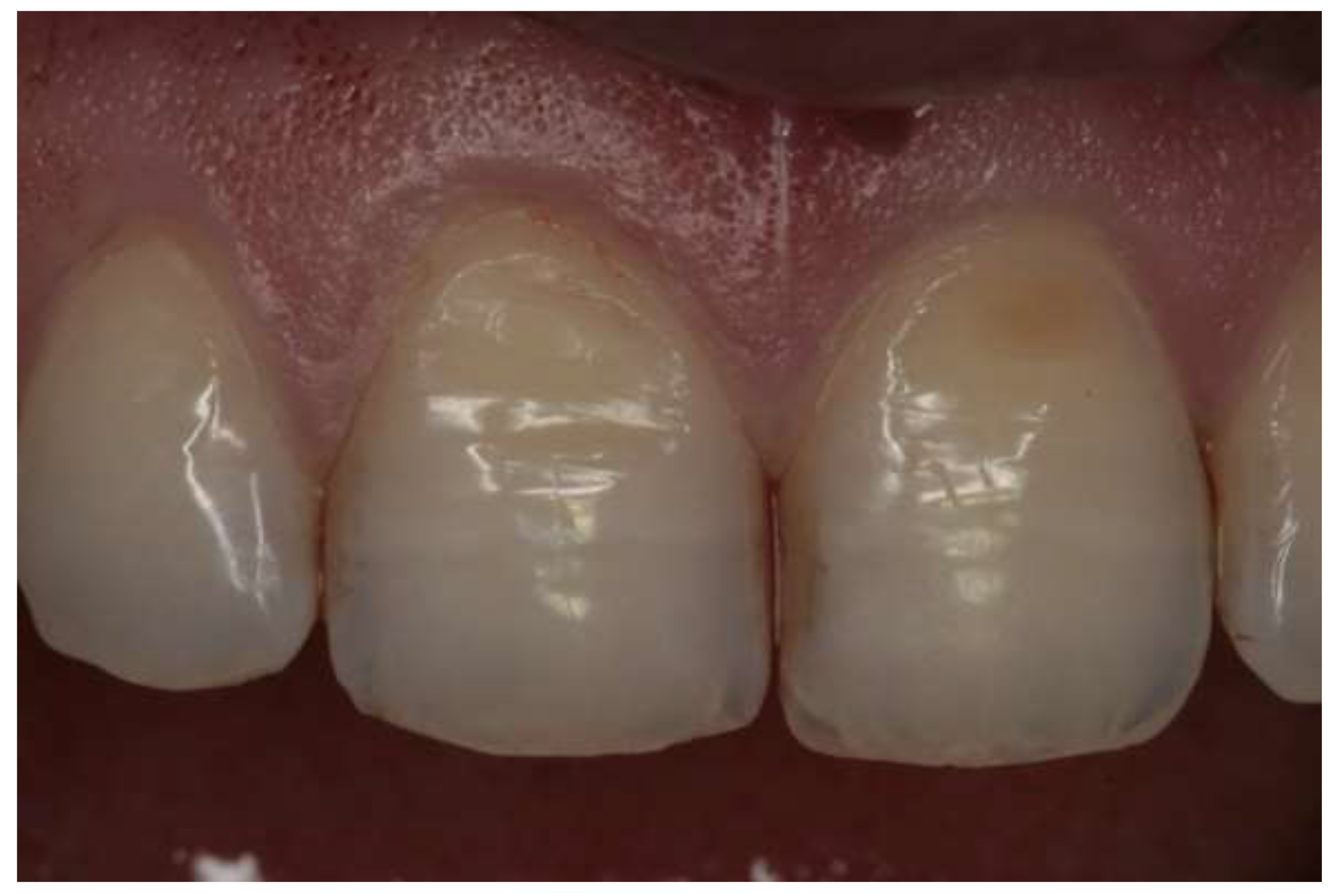 Ijerph 17 03002 g001