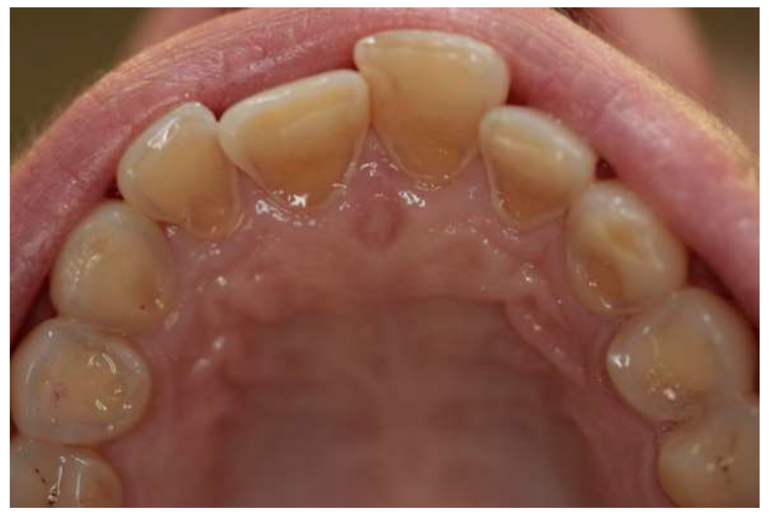 Ijerph 17 03002 g002