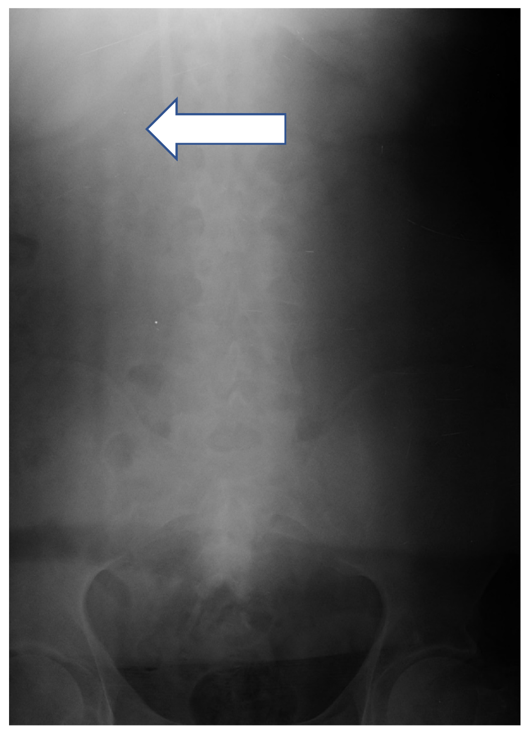 Ijerph 17 03027 g004