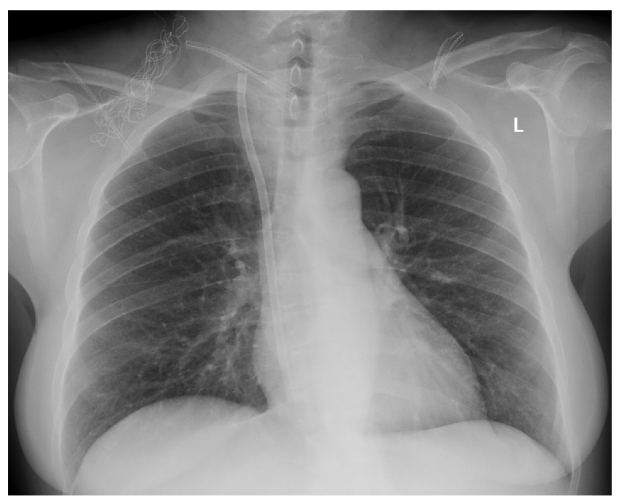 Ijerph 17 03027 g005