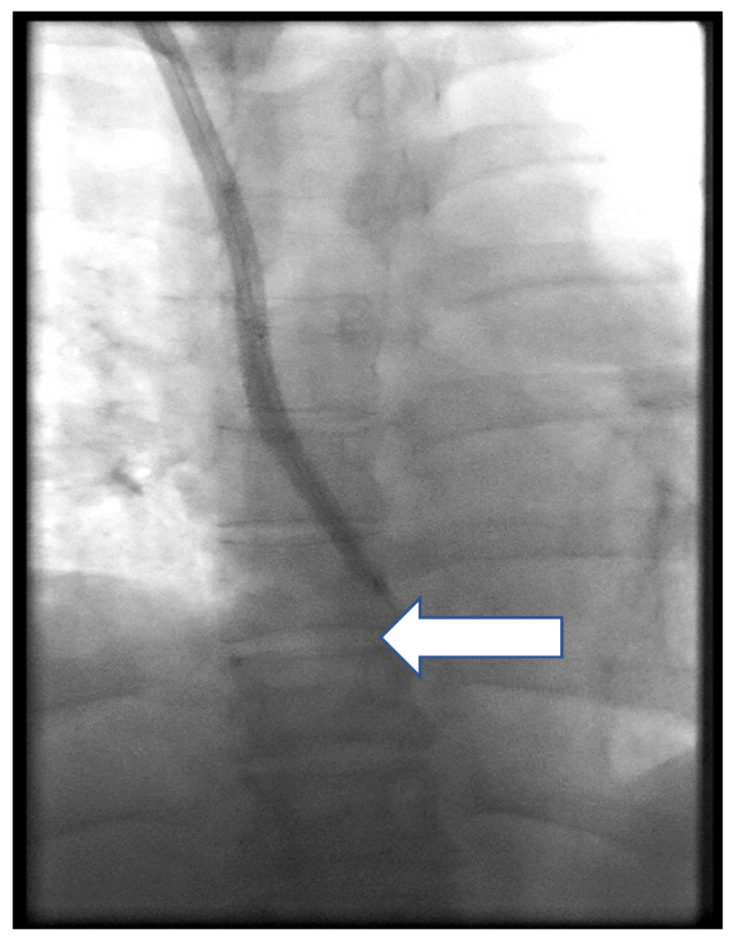 Ijerph 17 03027 g006