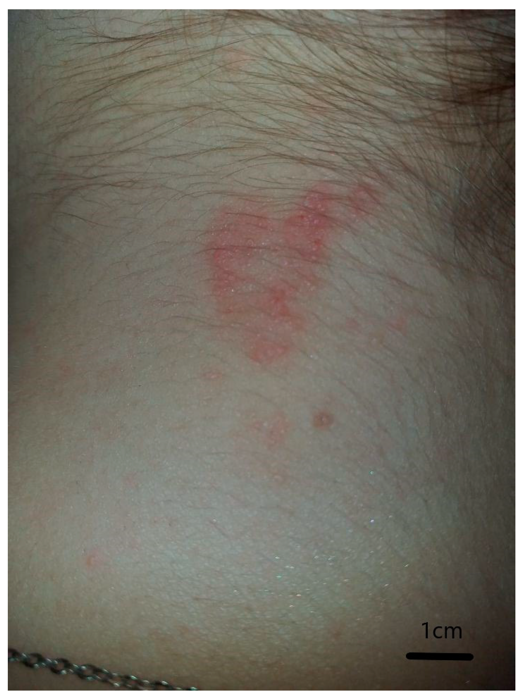 Ijerph 17 03316 g002