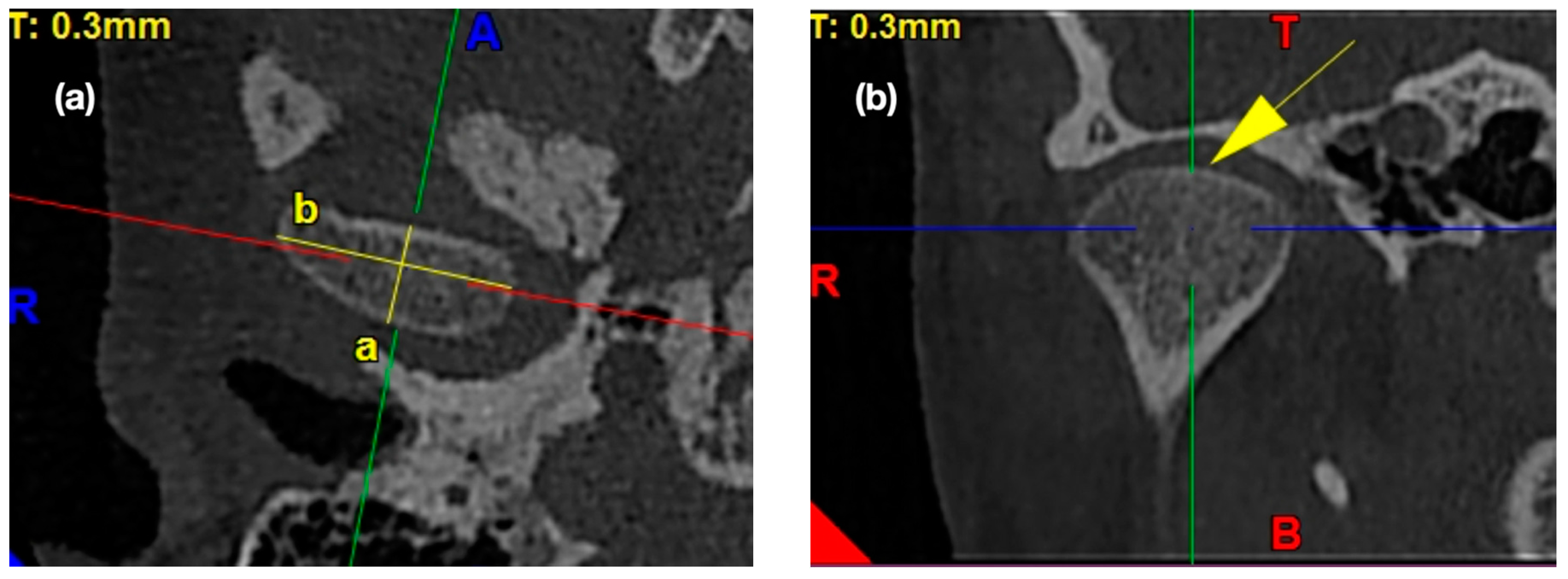 Ijerph 17 03428 g002 Ijerph 17 03428 g002