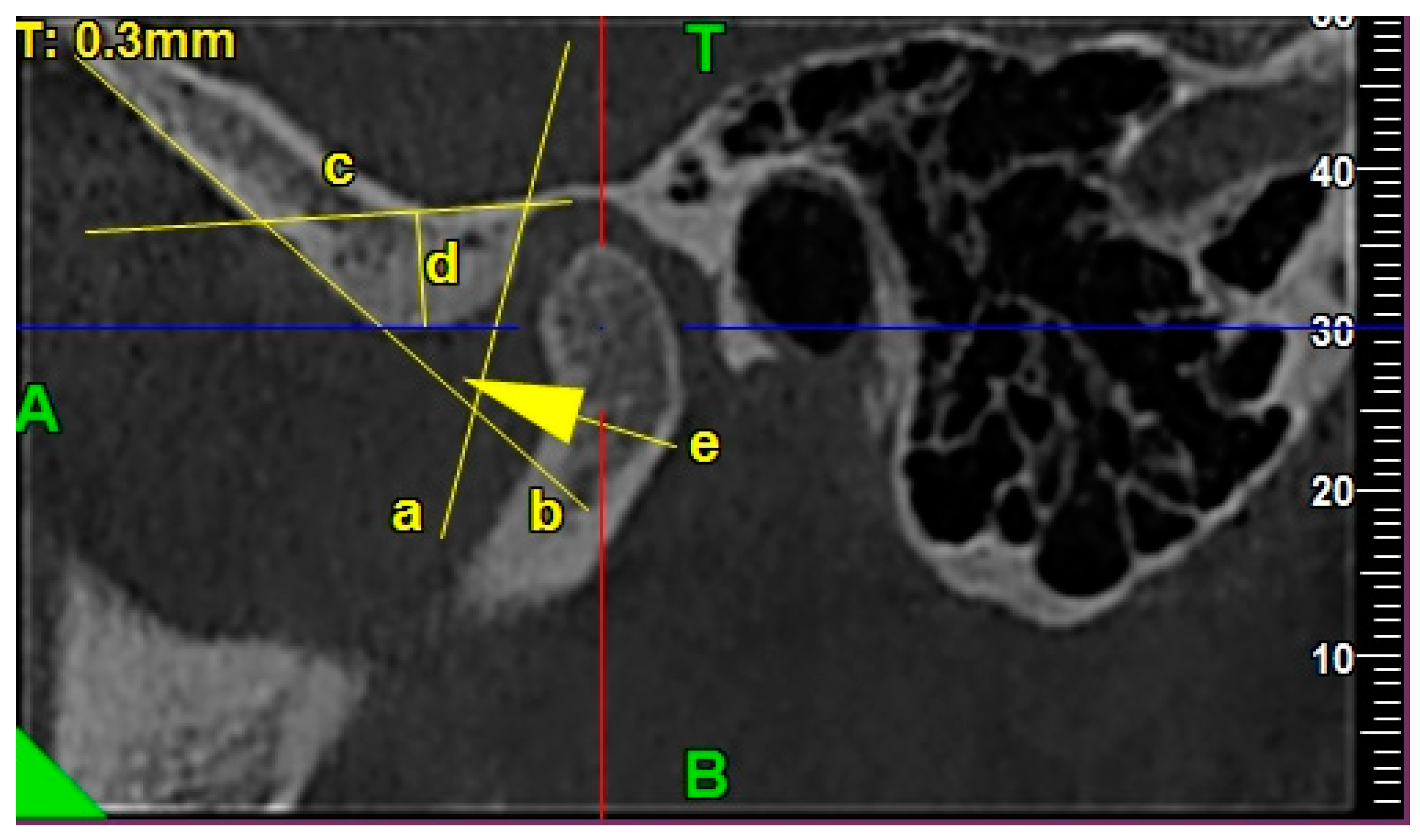 Ijerph 17 03428 g004 Ijerph 17 03428 g004