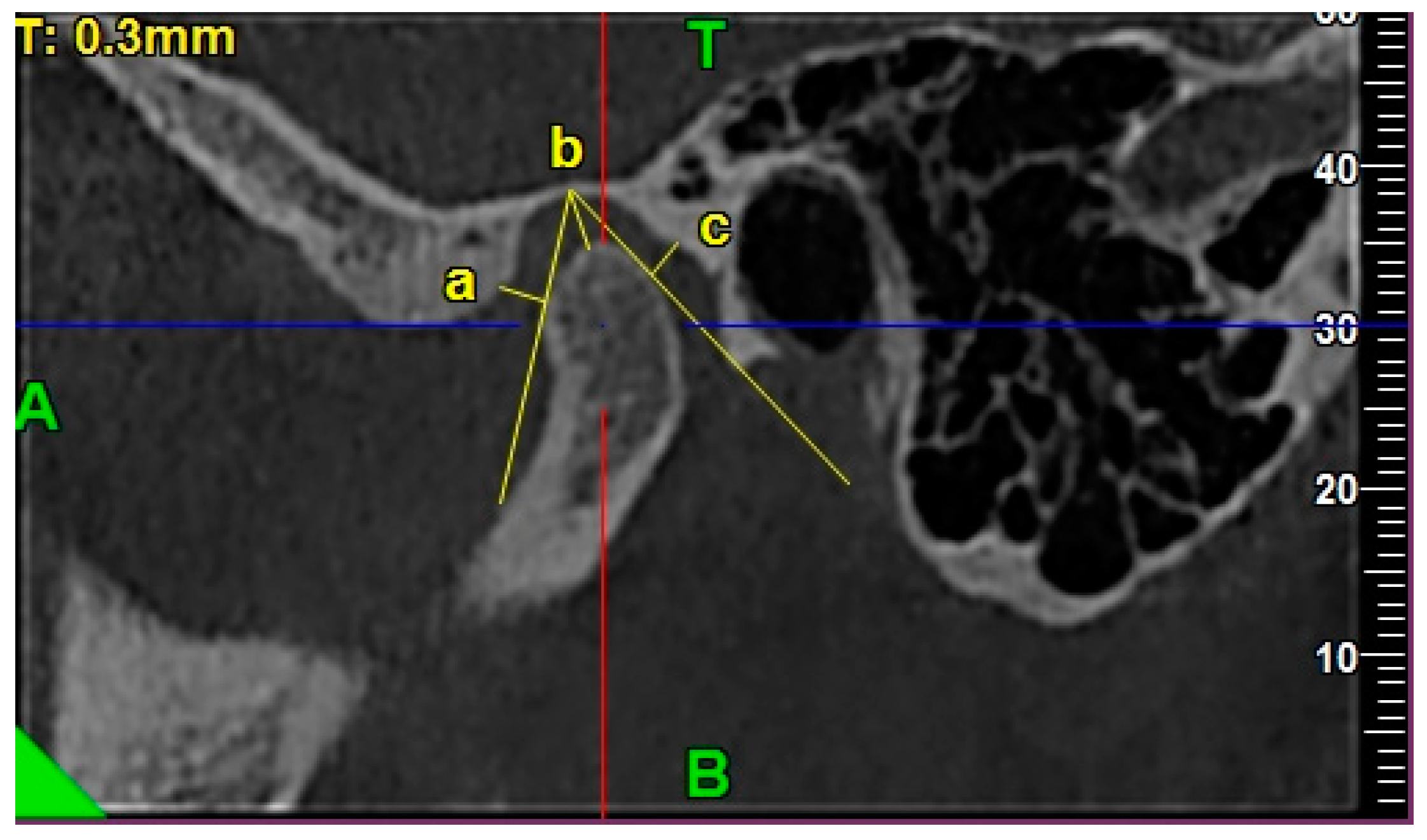 Ijerph 17 03428 g005 Ijerph 17 03428 g005