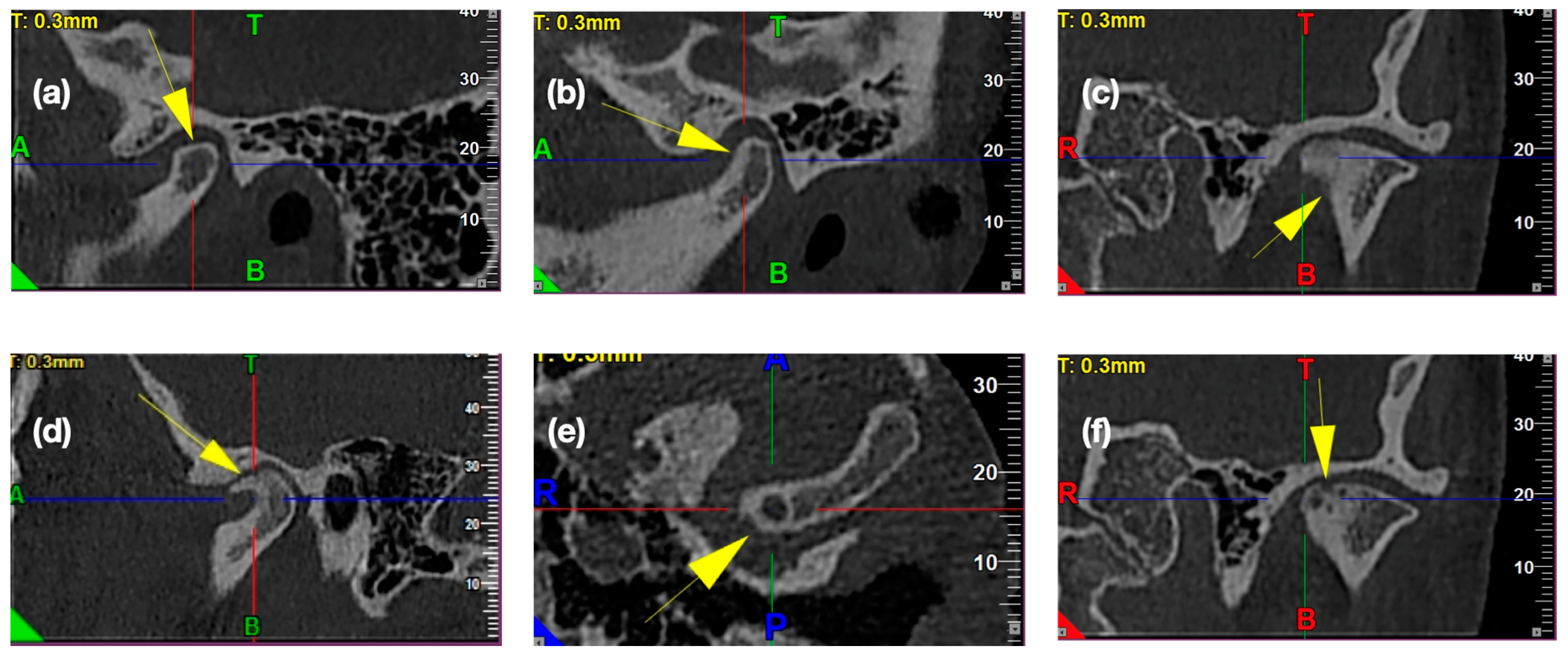 Ijerph 17 03428 g006 Ijerph 17 03428 g006