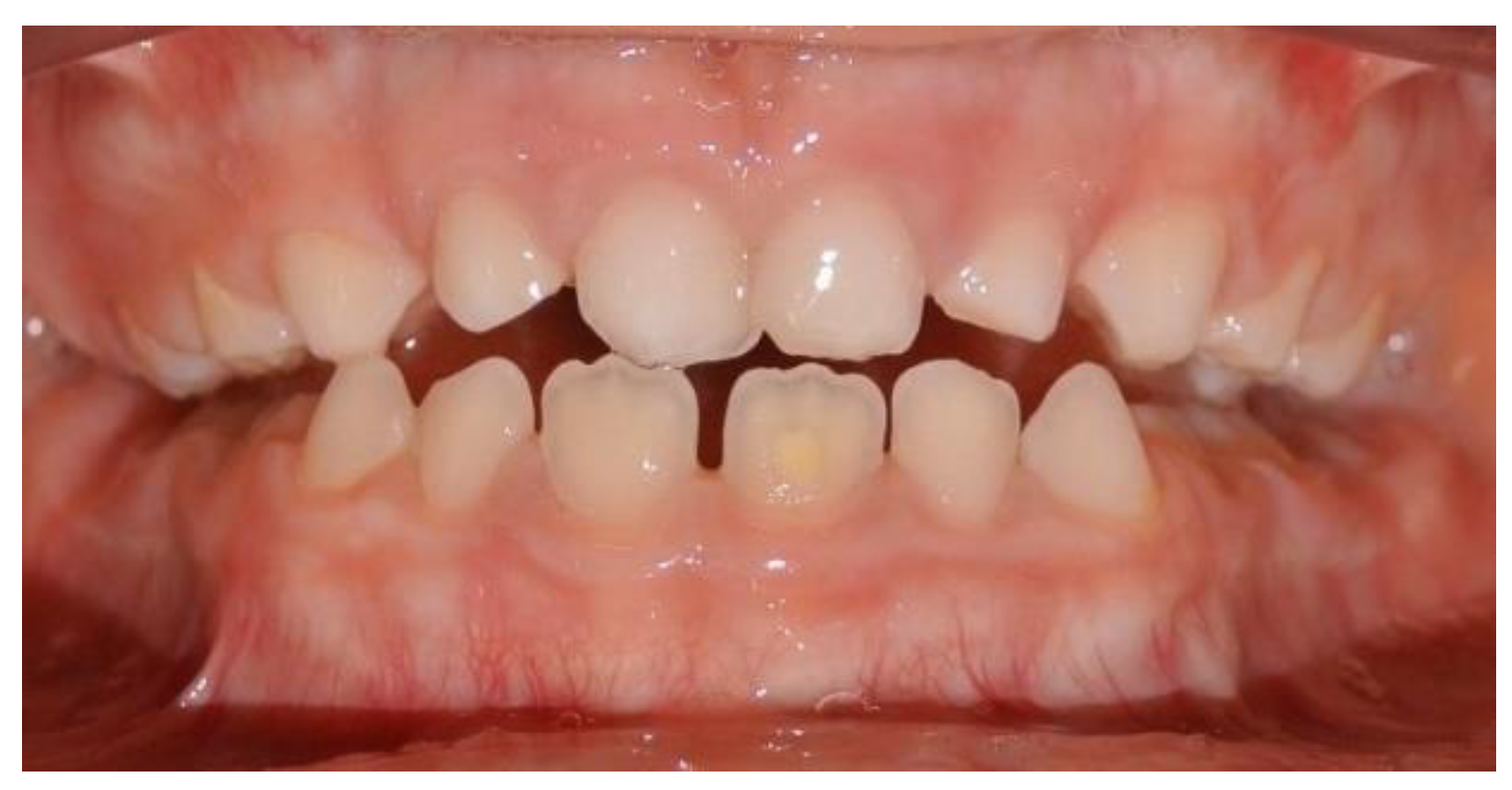 Ijerph 17 03587 g005