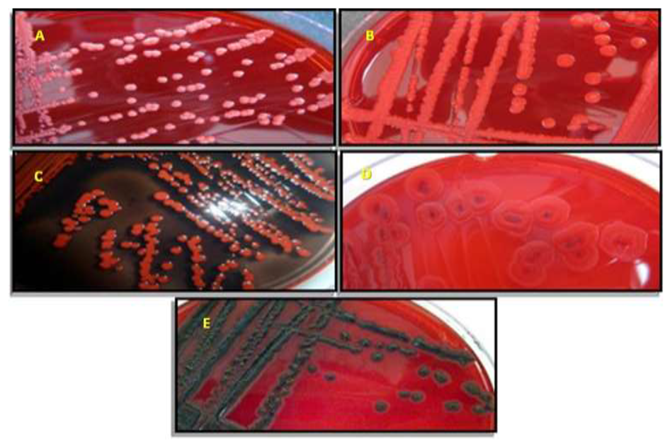 Ijerph 17 03761 g002 Ijerph 17 03761 g002