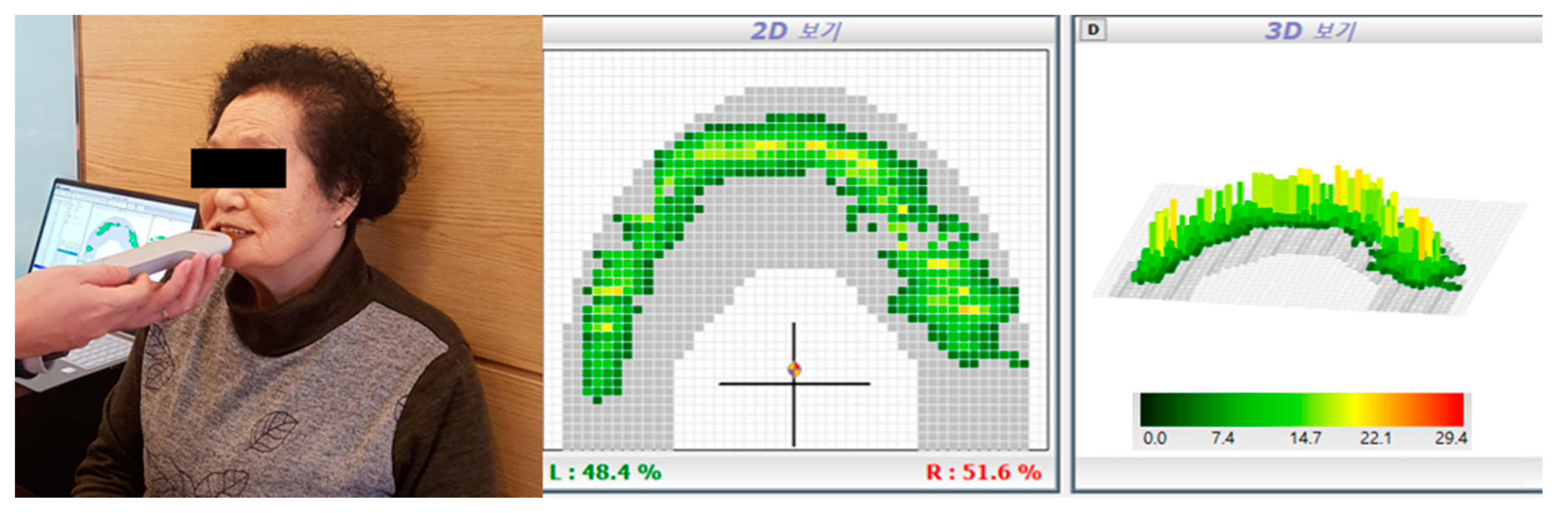Ijerph 17 03783 g004