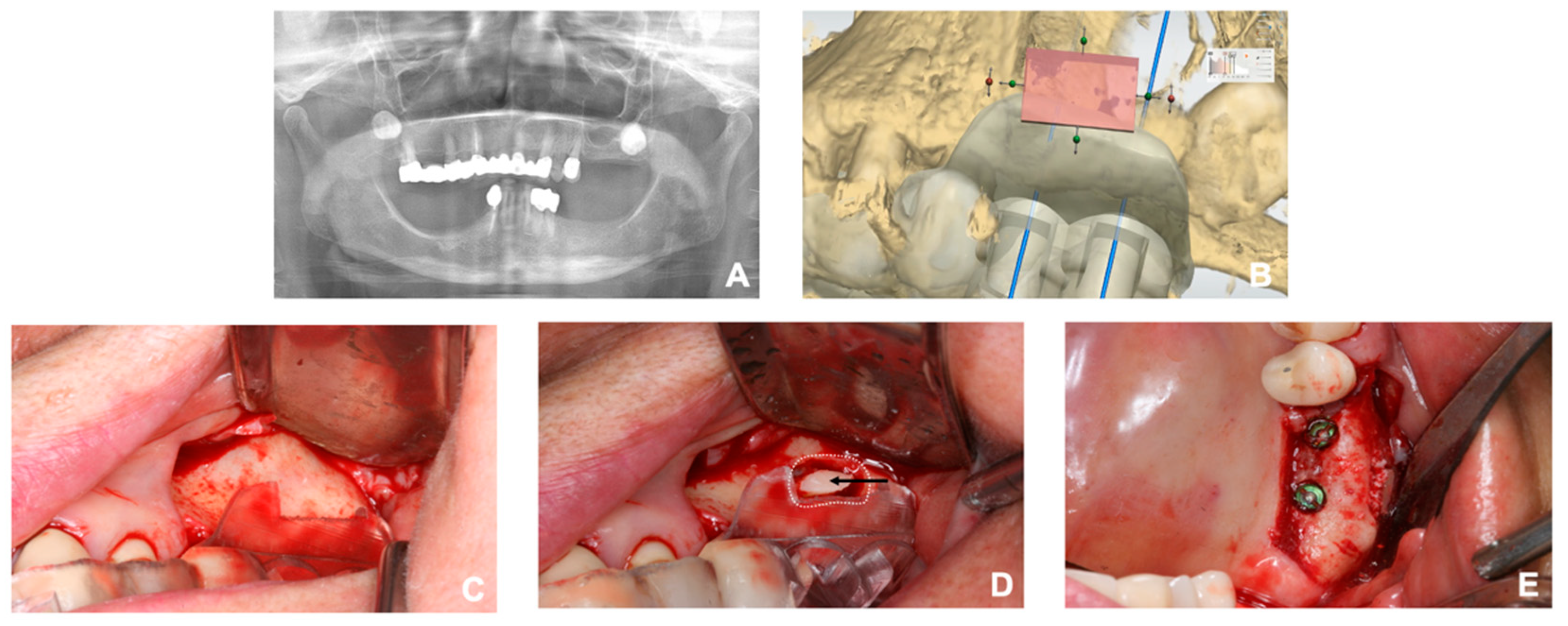 Ijerph 17 03785 g001