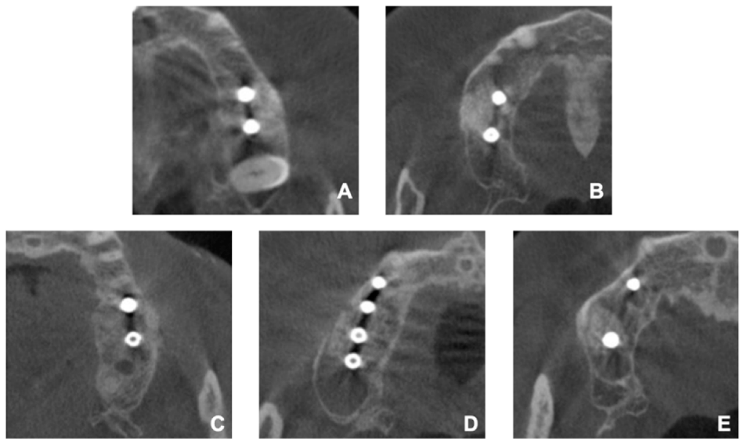 Ijerph 17 03785 g004