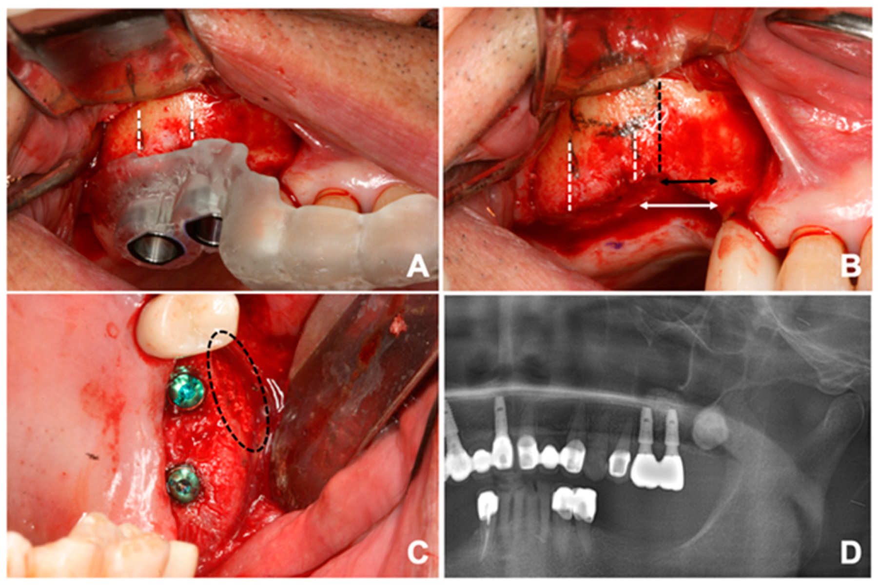 Ijerph 17 03785 g005