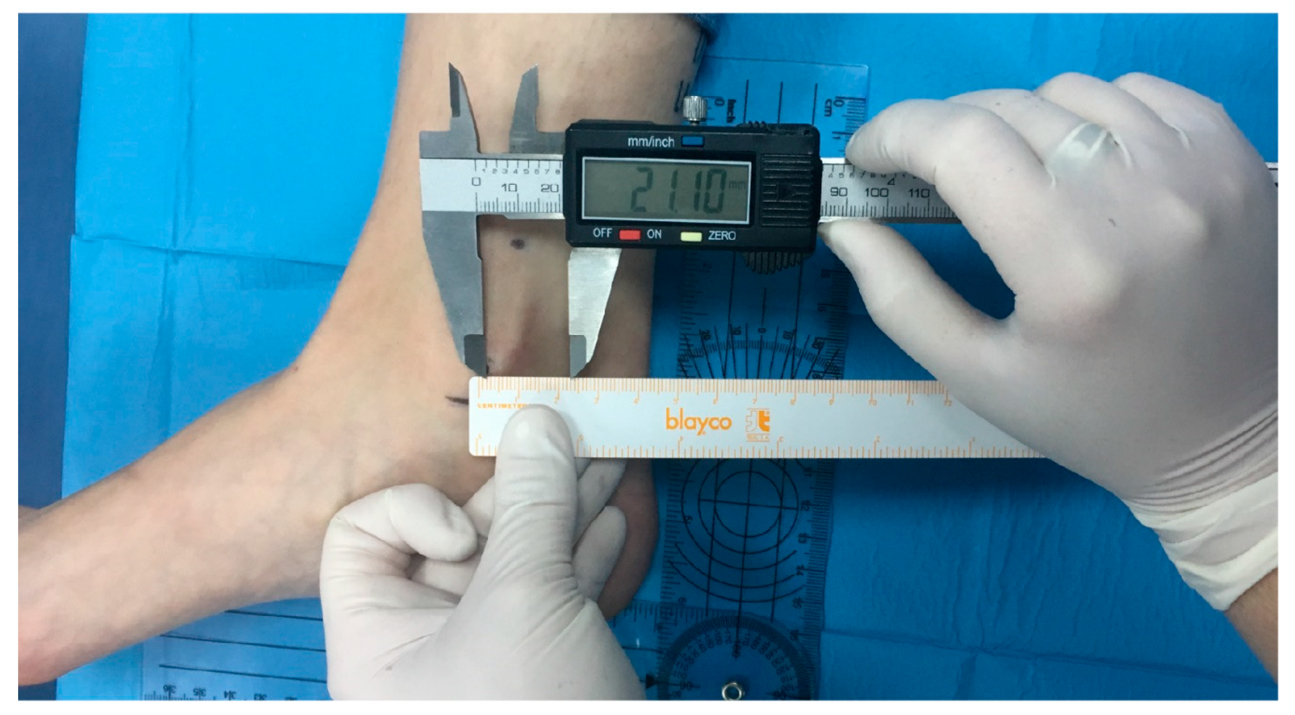 Ijerph 17 03860 g002