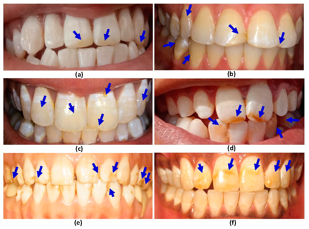 Ijerph 17 03914 g003