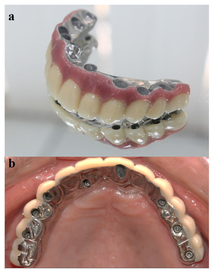 Retainer Box Small  Belur Orthodontics