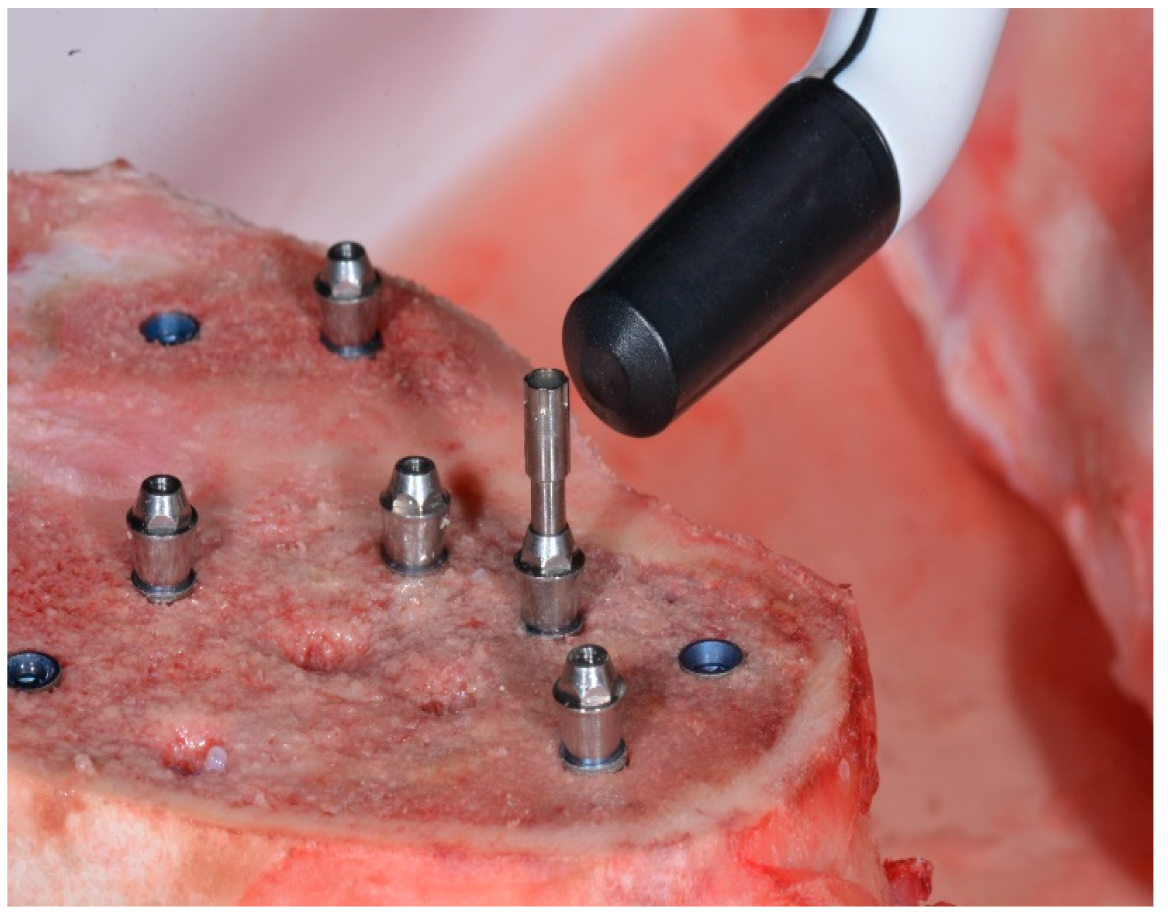 Ijerph 17 04073 g002 Ijerph 17 04073 g002