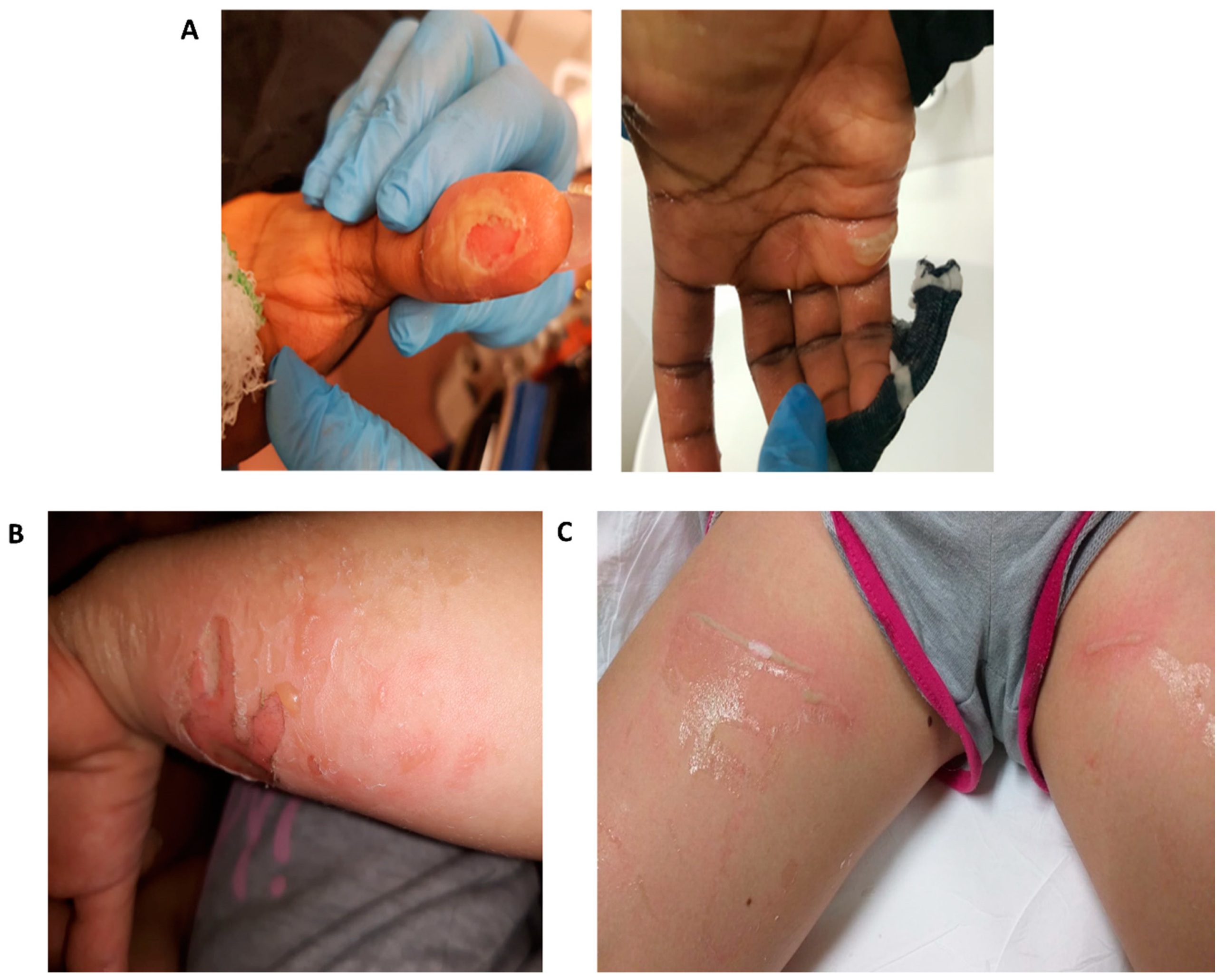 Ijerph 17 04283 g003