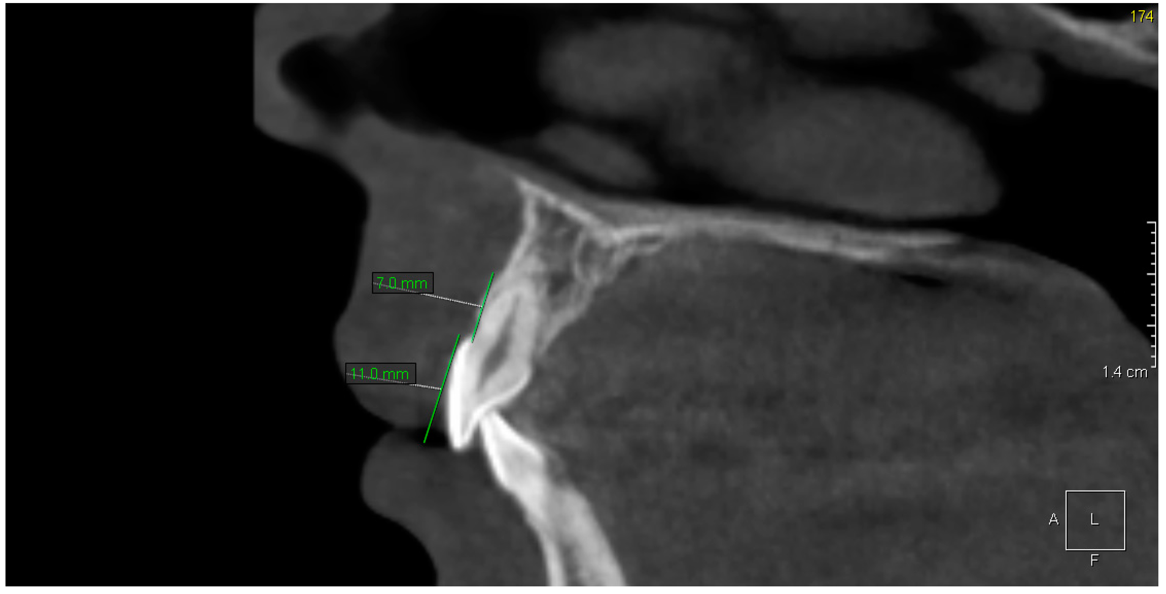 Ijerph 17 04337 g002