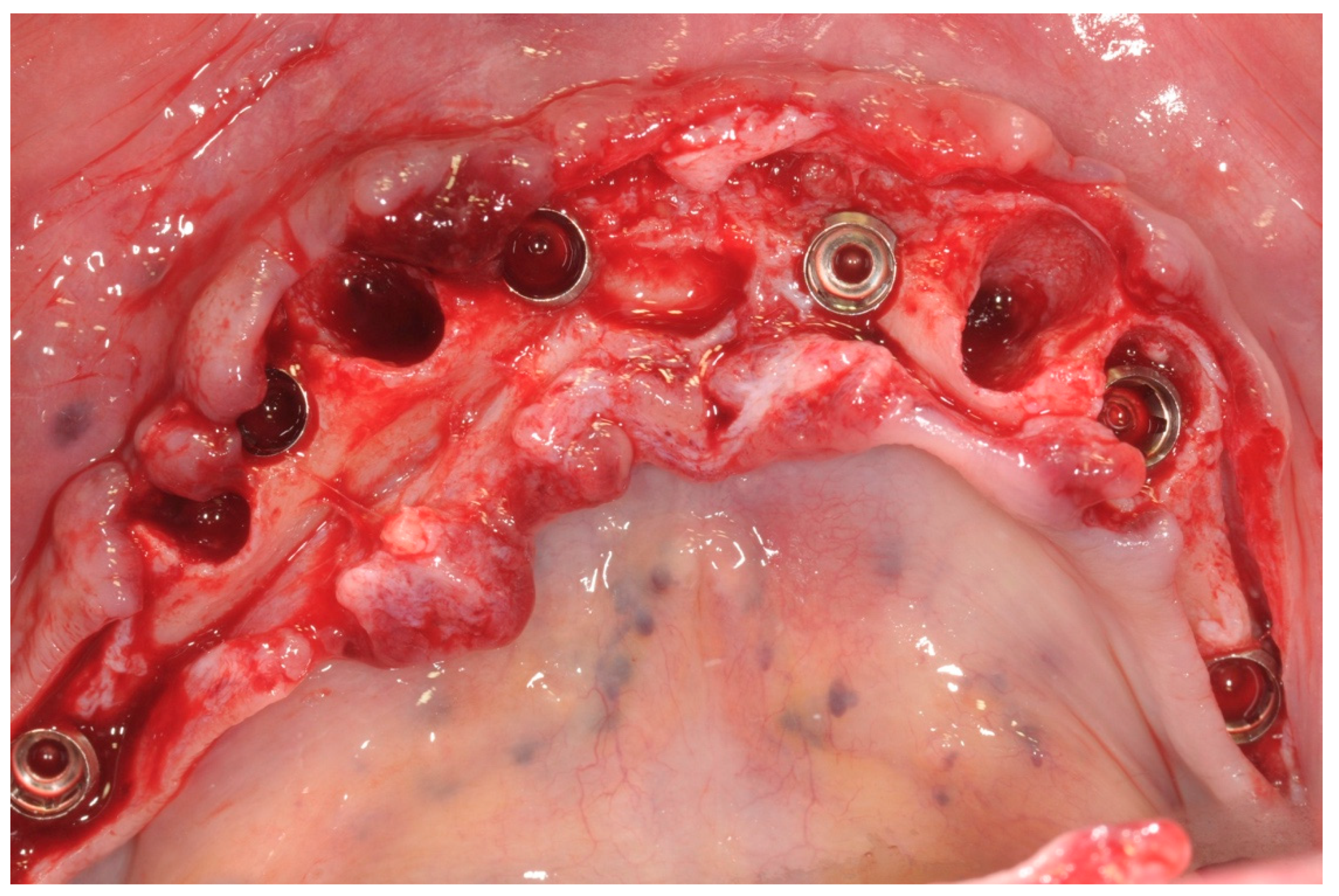 Ijerph 17 04607 g003