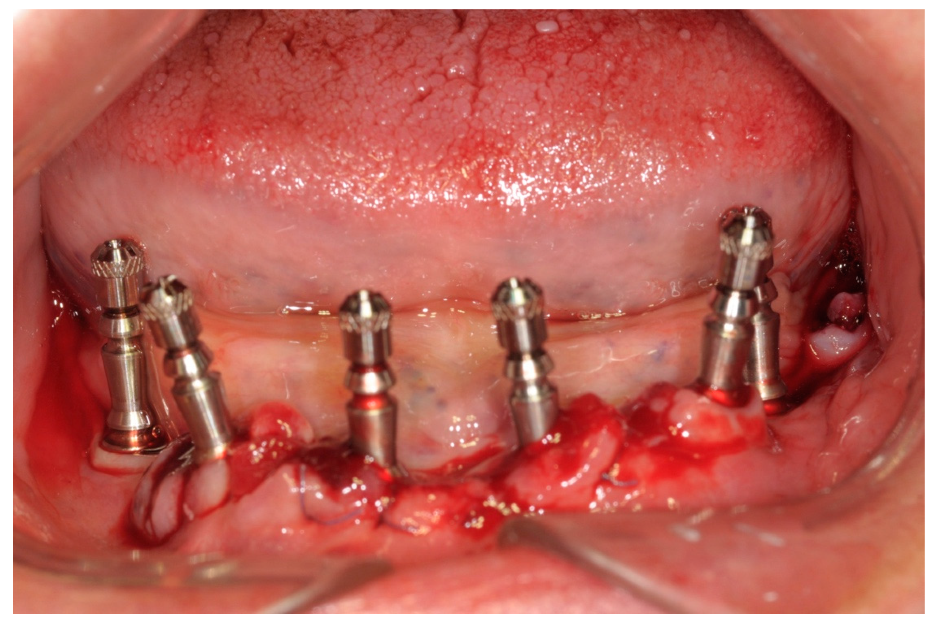 Ijerph 17 04607 g005