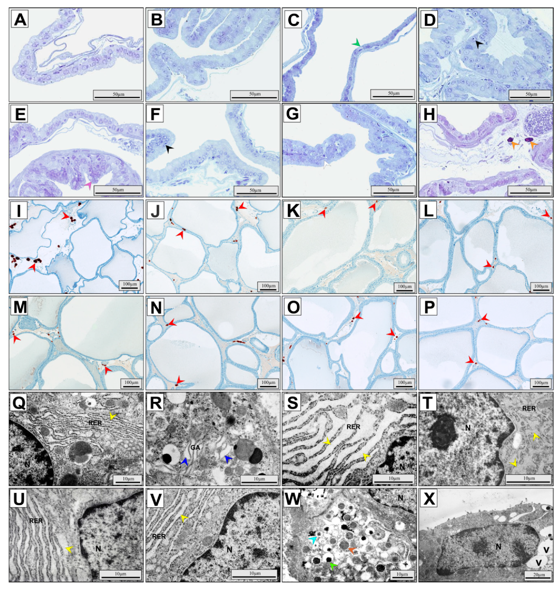 Ijerph 17 04614 g003