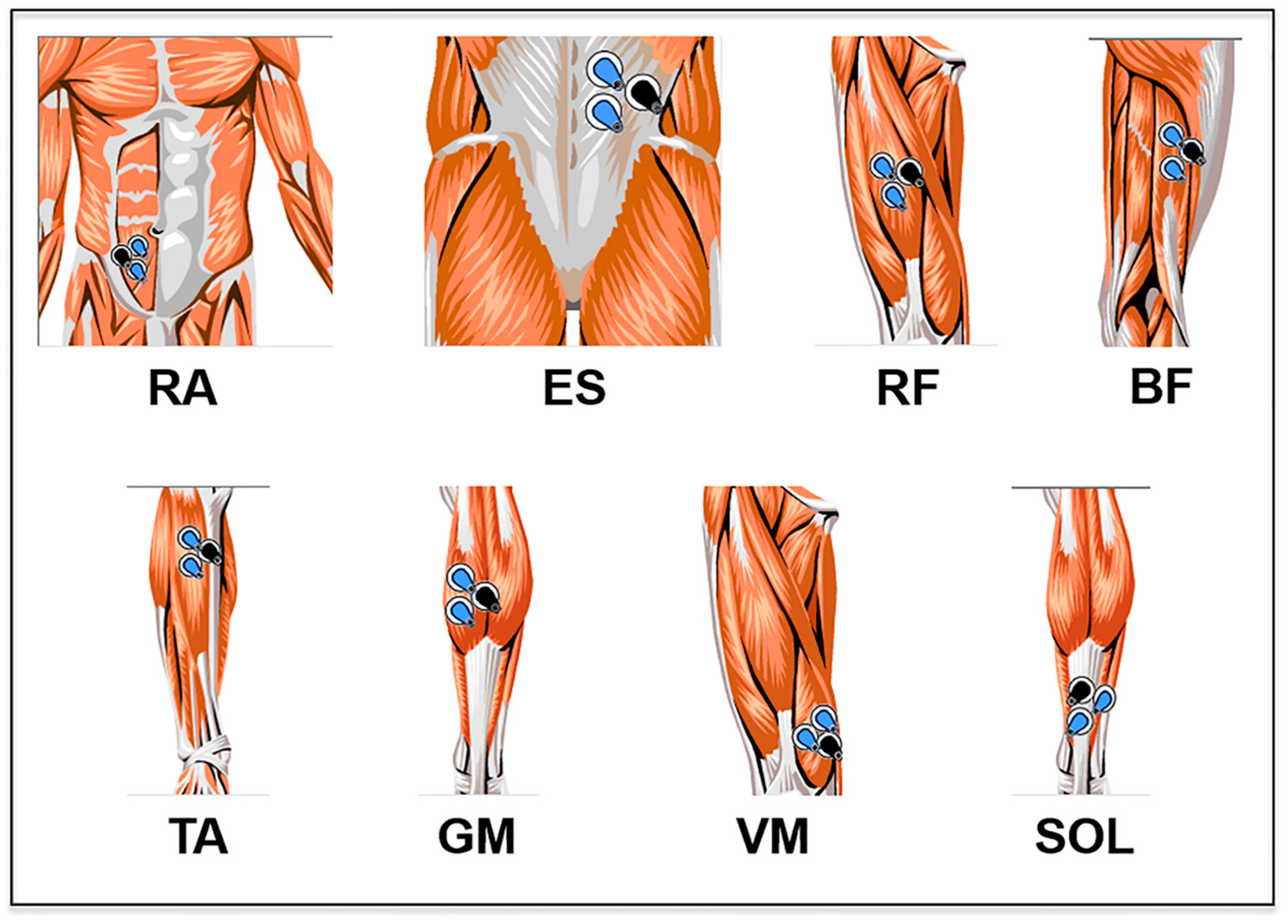 Differences in trunk and lower extremity muscle activity during