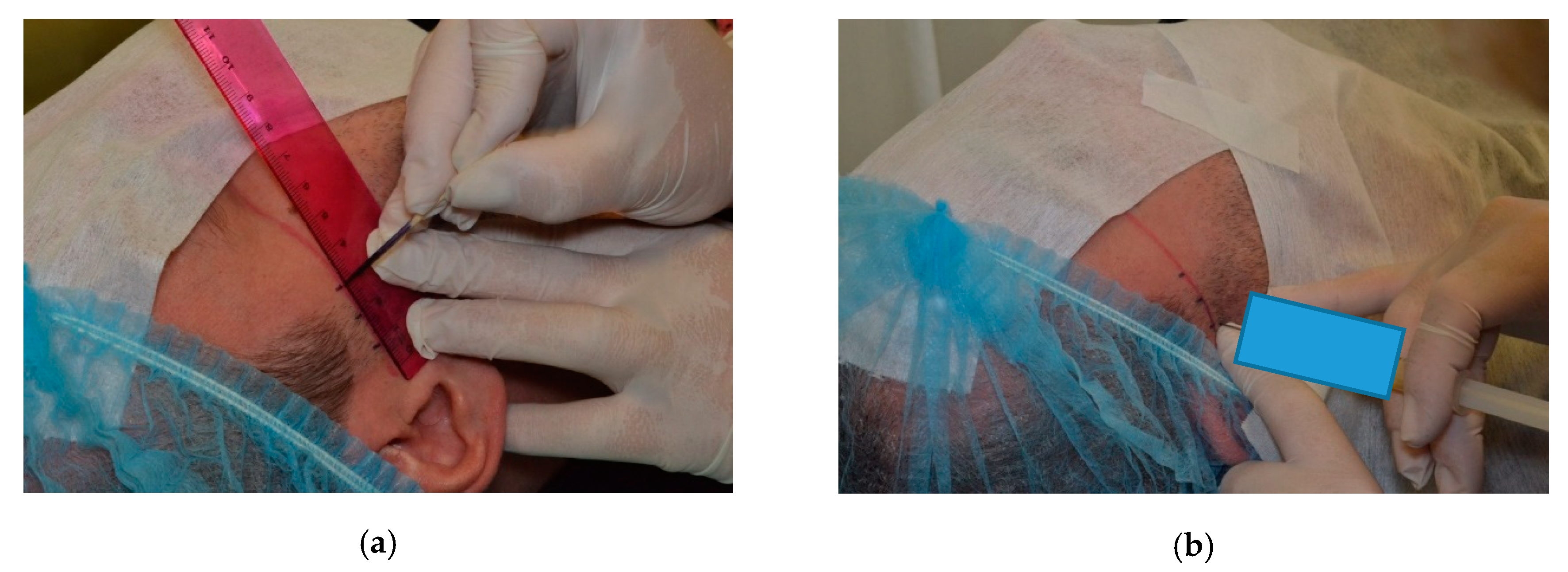 Ijerph 17 04726 g003