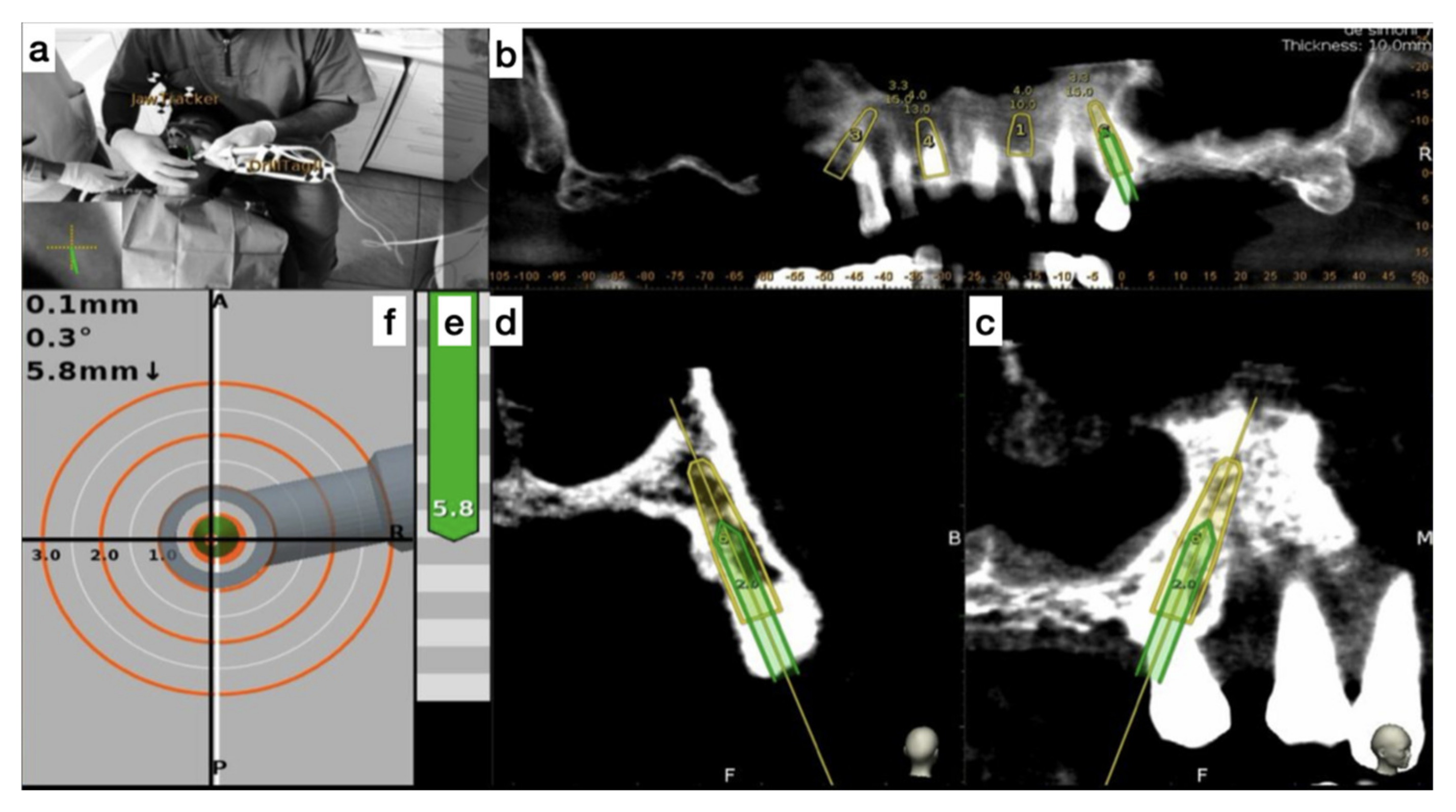 Ijerph 17 05038 g005