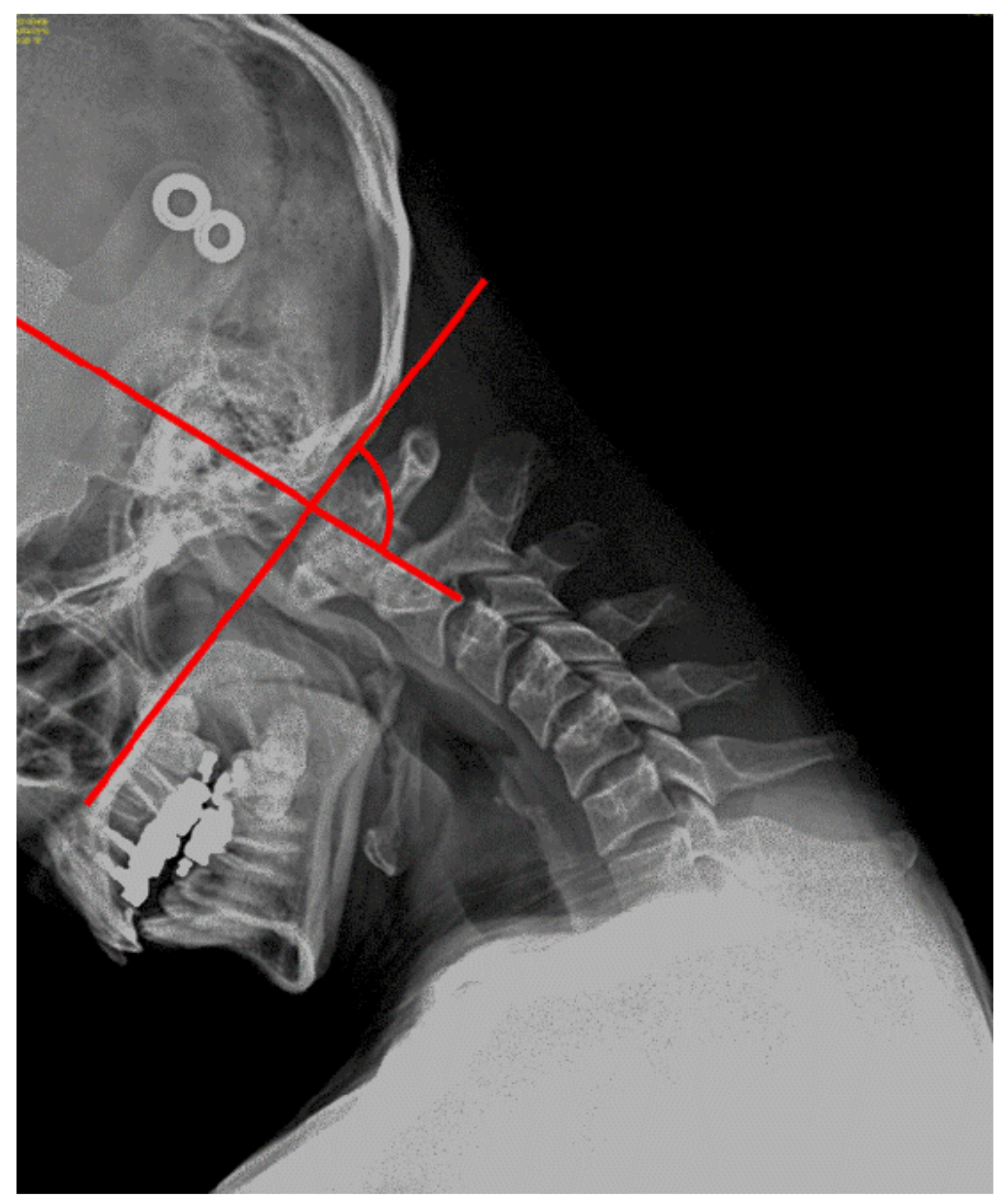 Ijerph 17 05262 g002