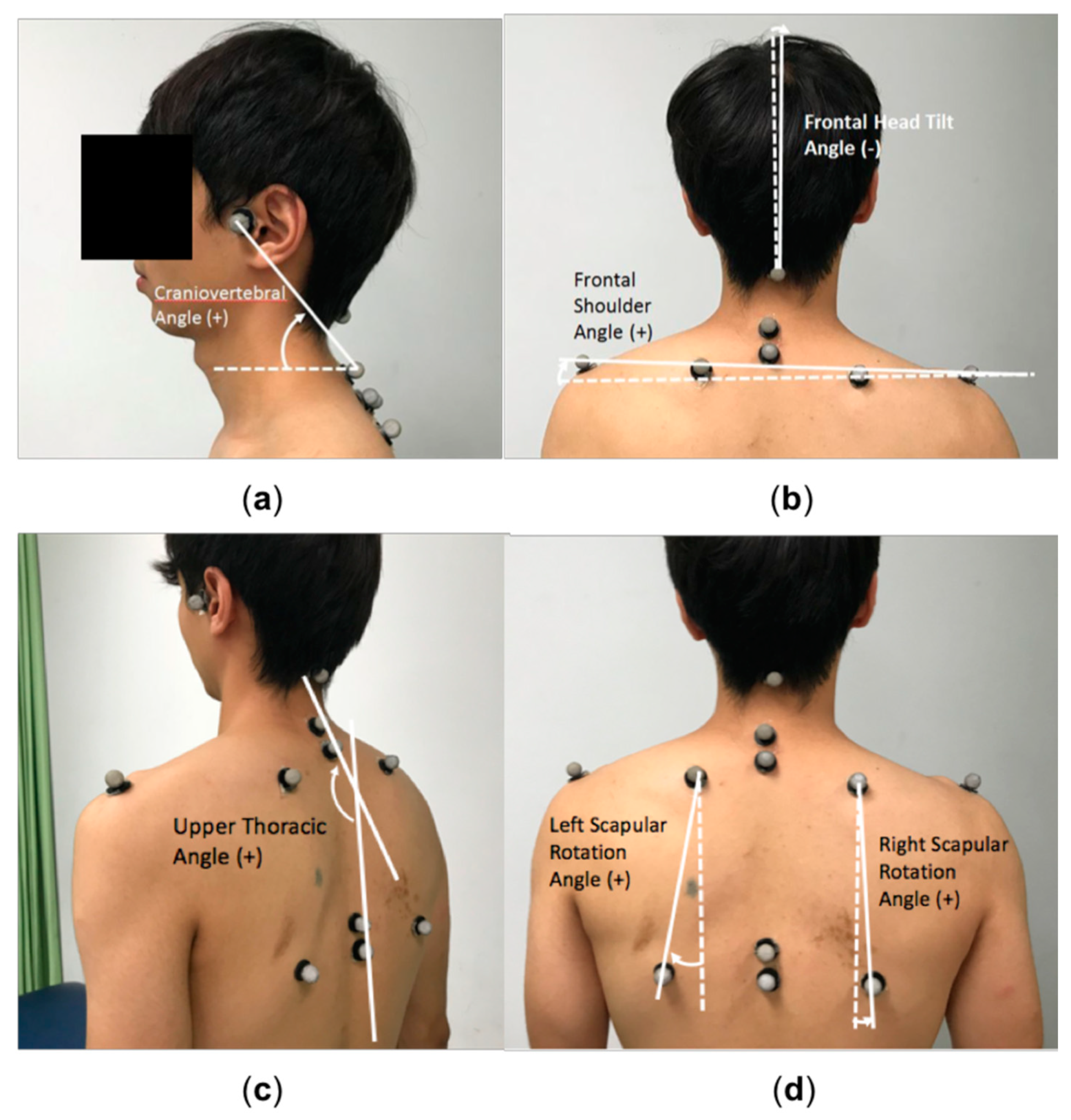 Cervical Placement for Neck Issues Example 