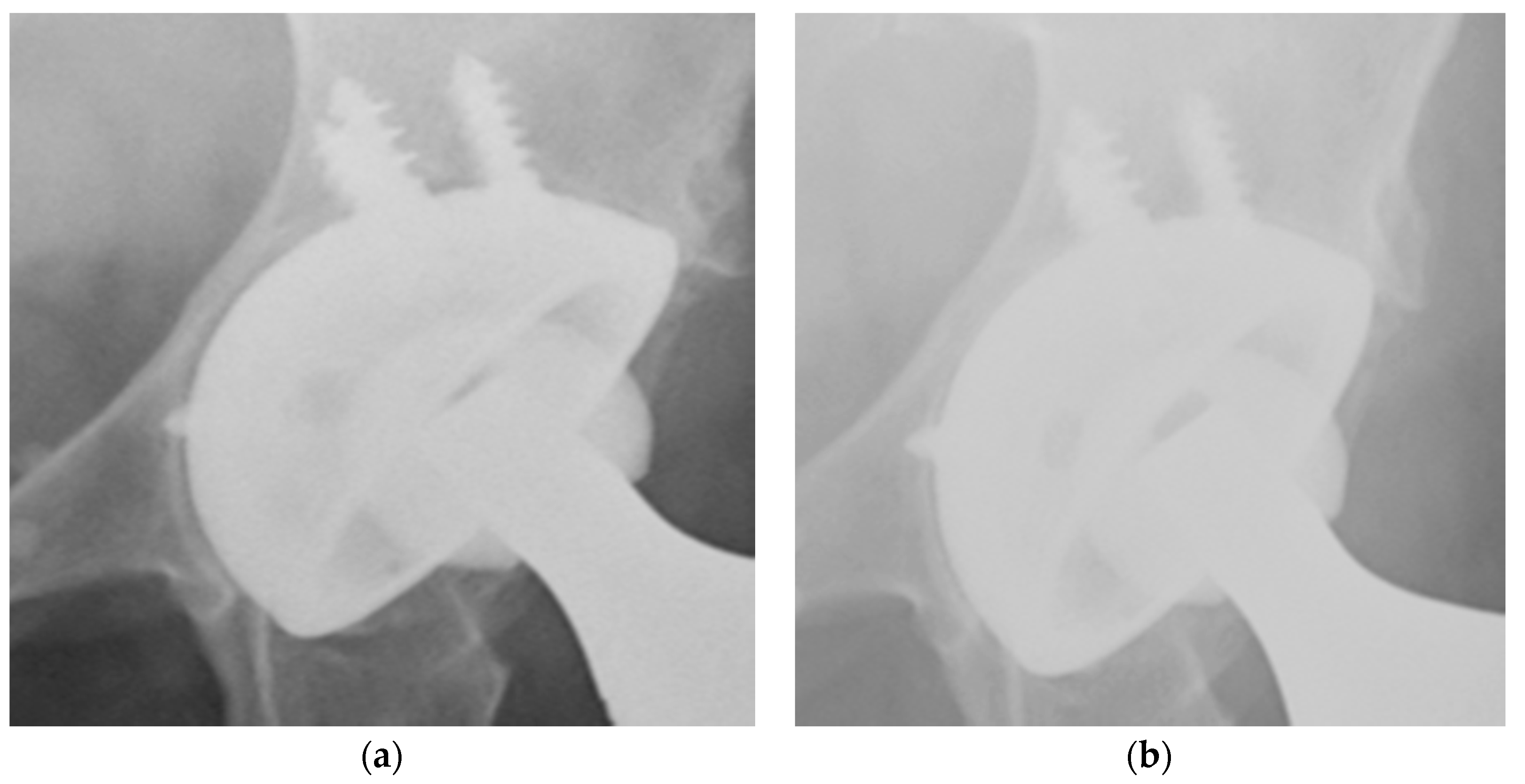 Ijerph 17 05624 g002