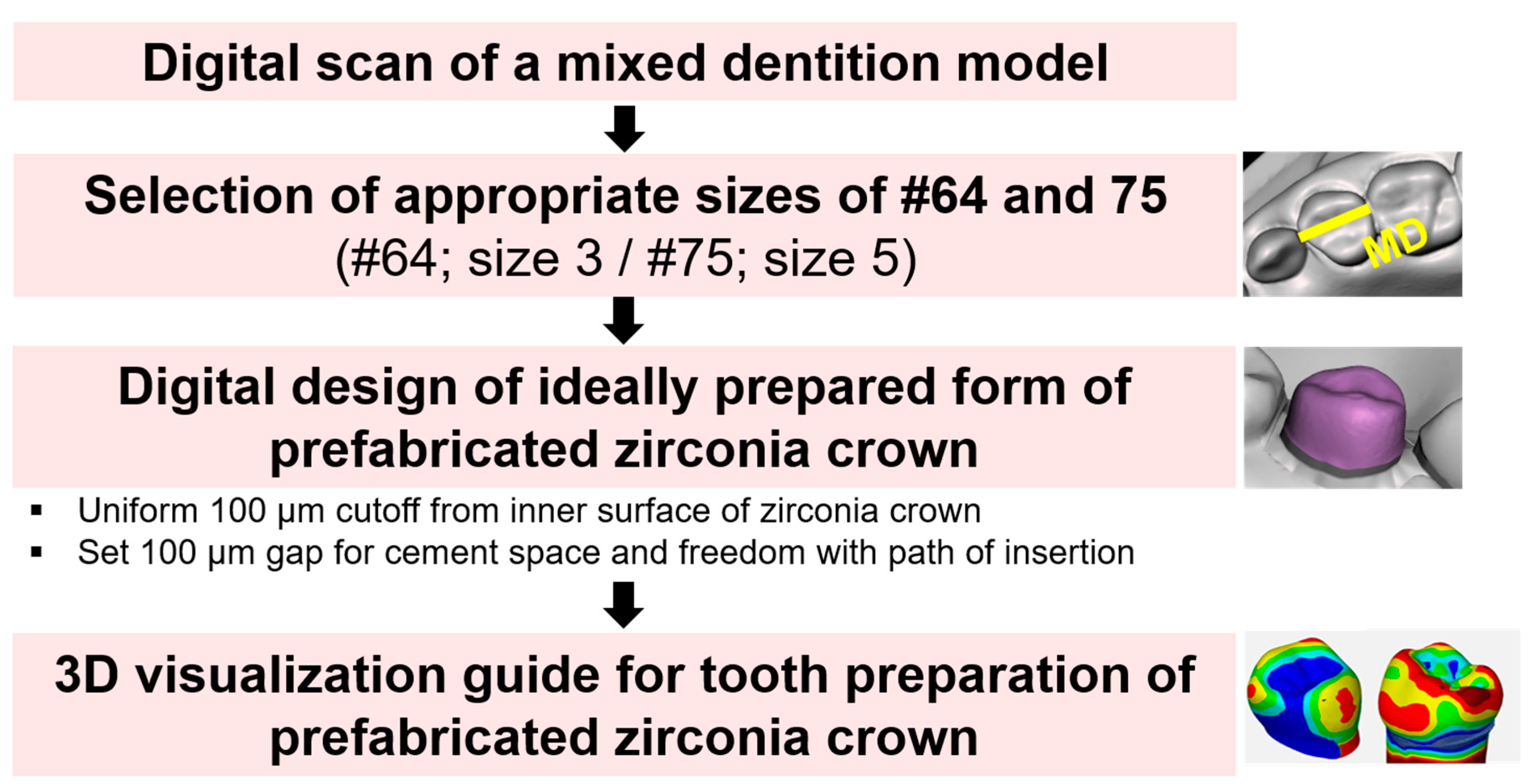 健康・医学 The Tooth Preparation 書籍詳細「The Tooth Preparation」 | フォルディネット