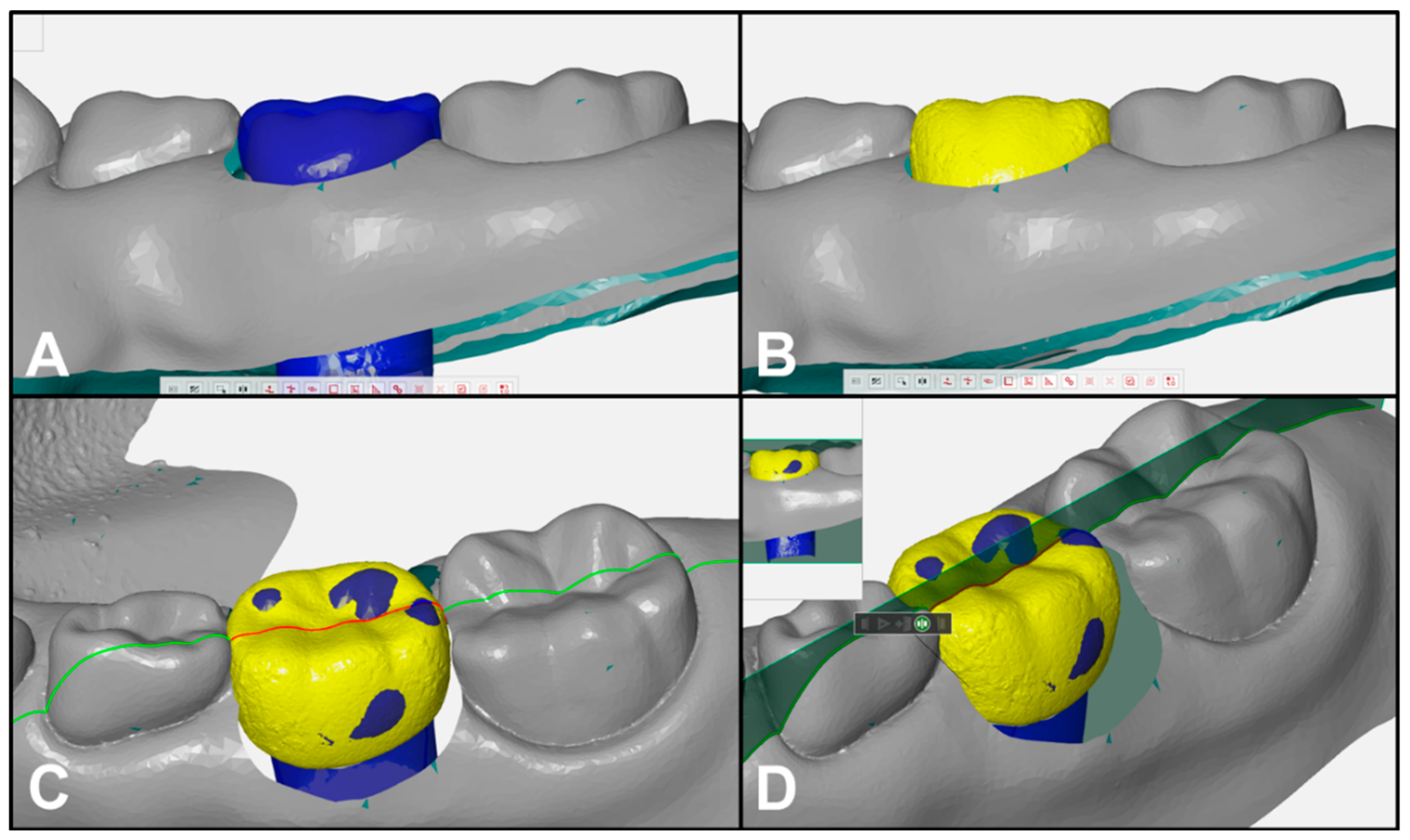 Ijerph 17 05732 g002 Ijerph 17 05732 g002