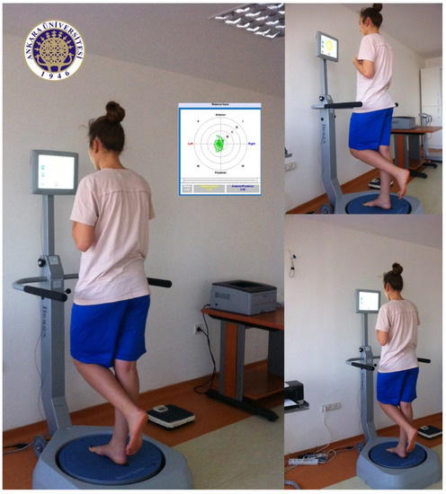 Effects of Aerobic and Anaerobic Fatigue Exercises on Postural 