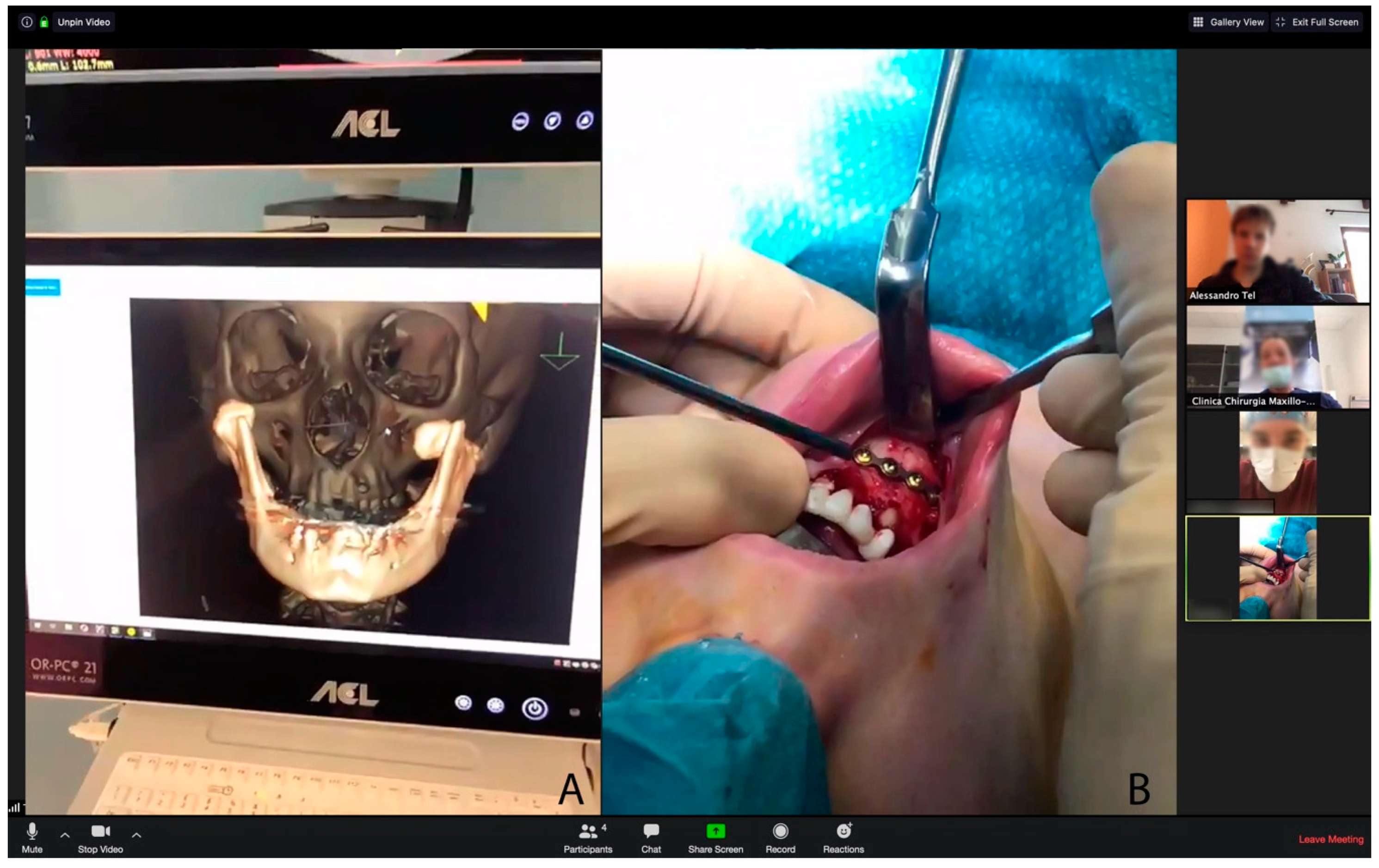 Ijerph 17 06622 g003